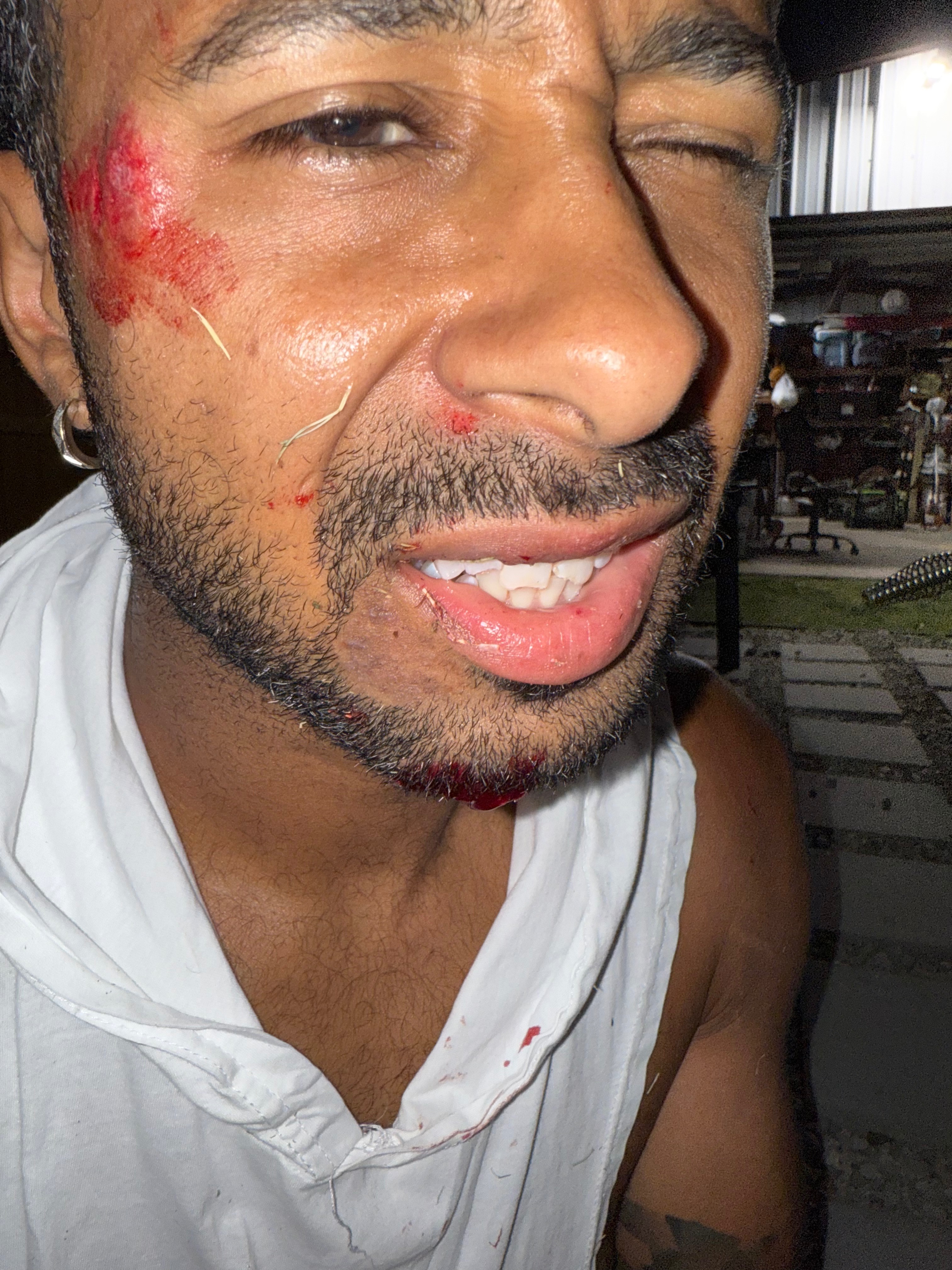 Support JT Small's Healing Journey and Medical Expenses campaign photo, 5 of 7
