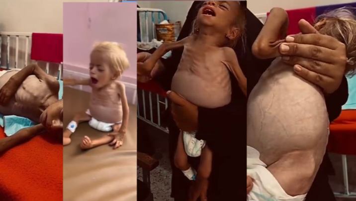 Urgent Appeal to Save 2-Year-Old Child, Sham, in Gaza photo