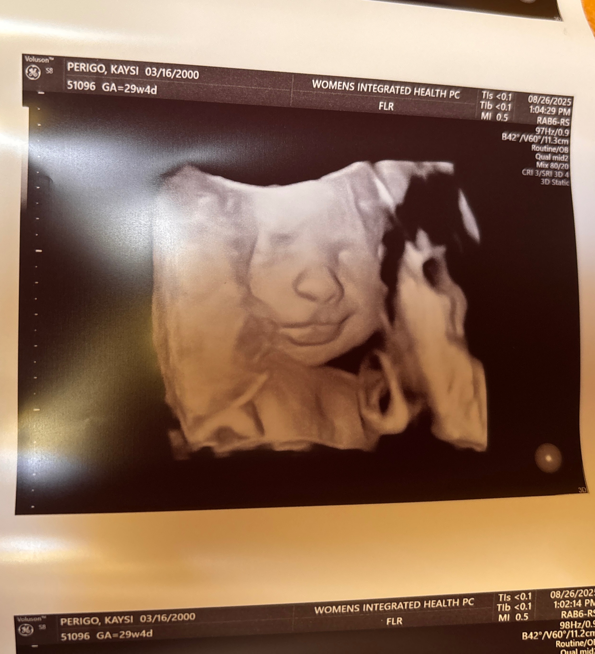 Help Kaysi Fight BreastCancer While Preparing for Motherhood campaign photo, 5 of 7