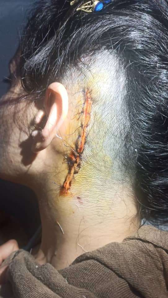 A brain cancer patient with two children needs help campaign photo, 7 of 8