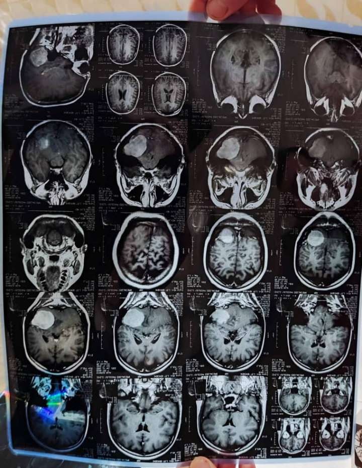 A brain cancer patient with two children needs help campaign photo, 2 of 8