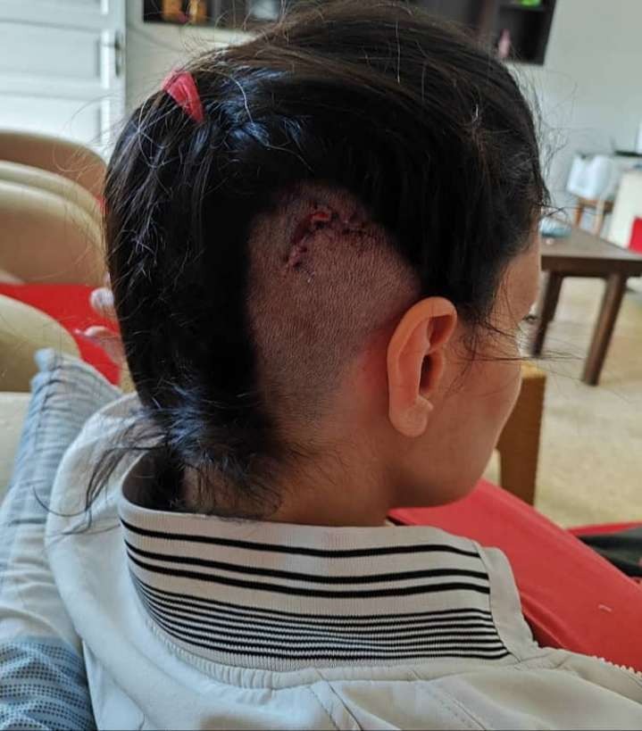 A brain cancer patient with two children needs help campaign photo, 5 of 8