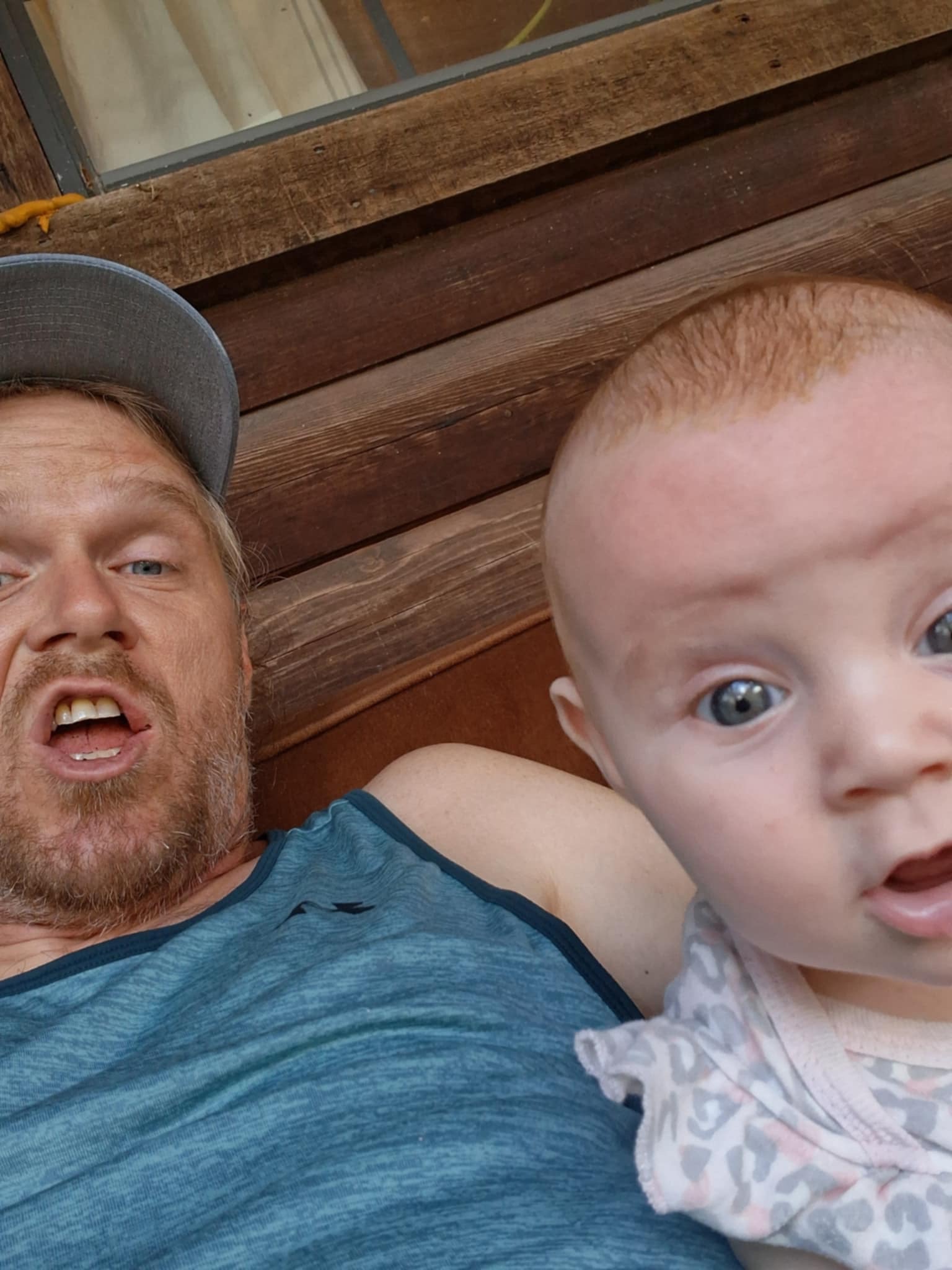 Help Kyle Get Surgery After His Scooter Accident campaign photo, 4 of 8