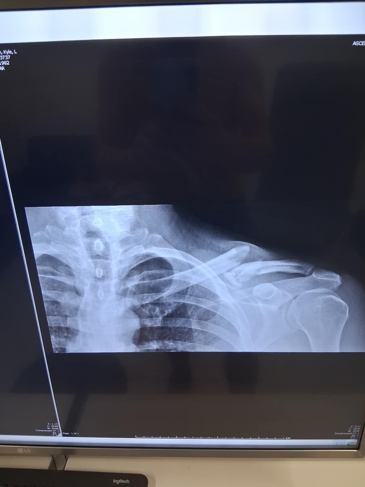 Help Kyle Get Surgery After His Scooter Accident campaign photo, 5 of 8