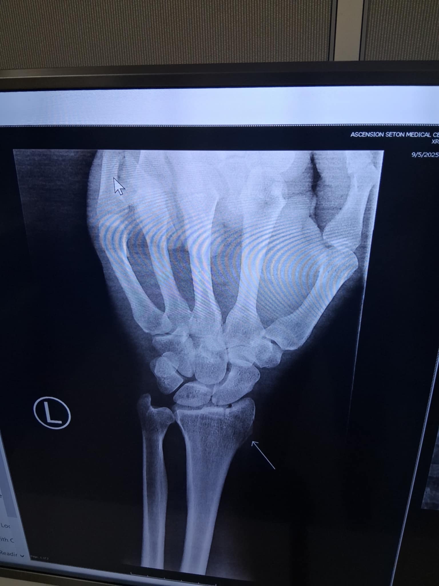 Help Kyle Get Surgery After His Scooter Accident campaign photo, 6 of 8