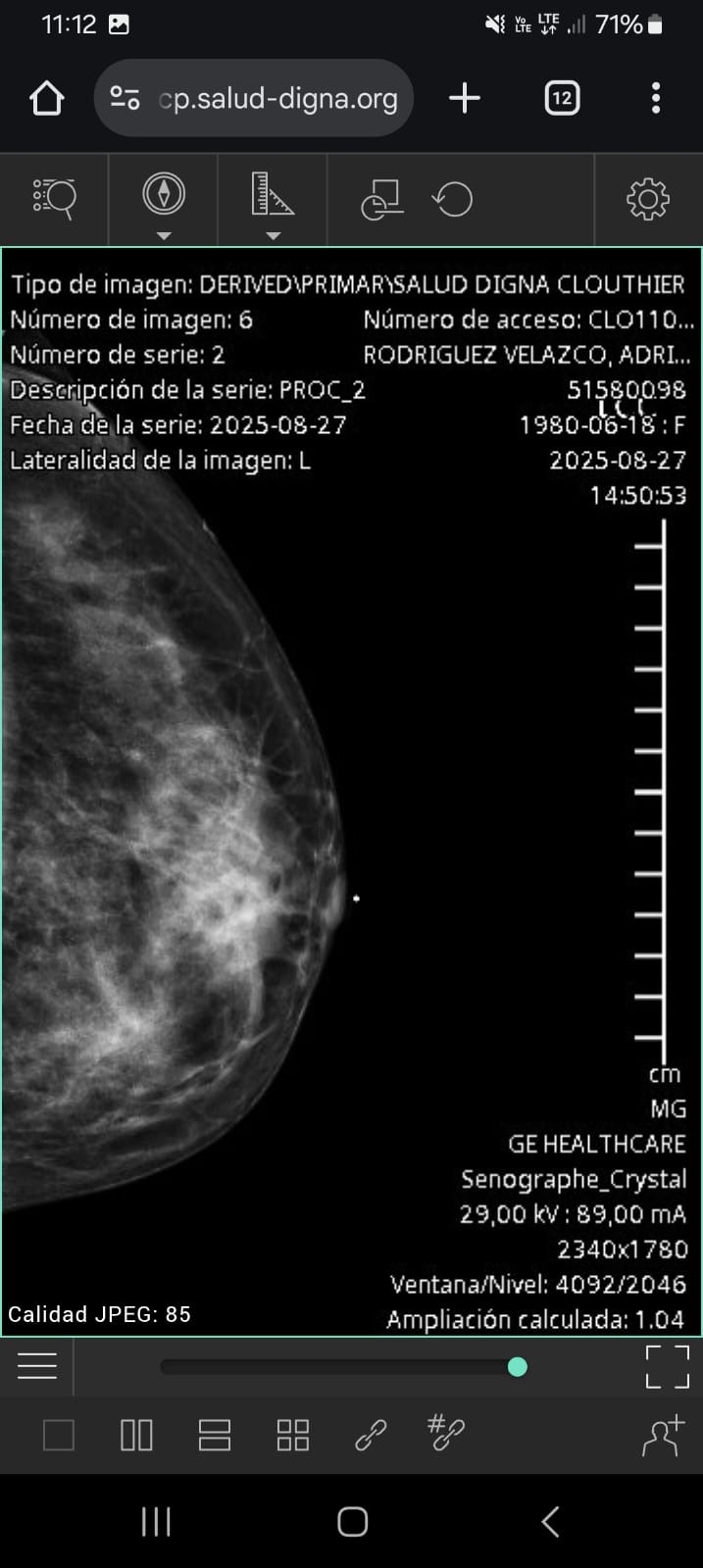 URGE OPERACION PARA ARACELY campaign photo, 2 of 6