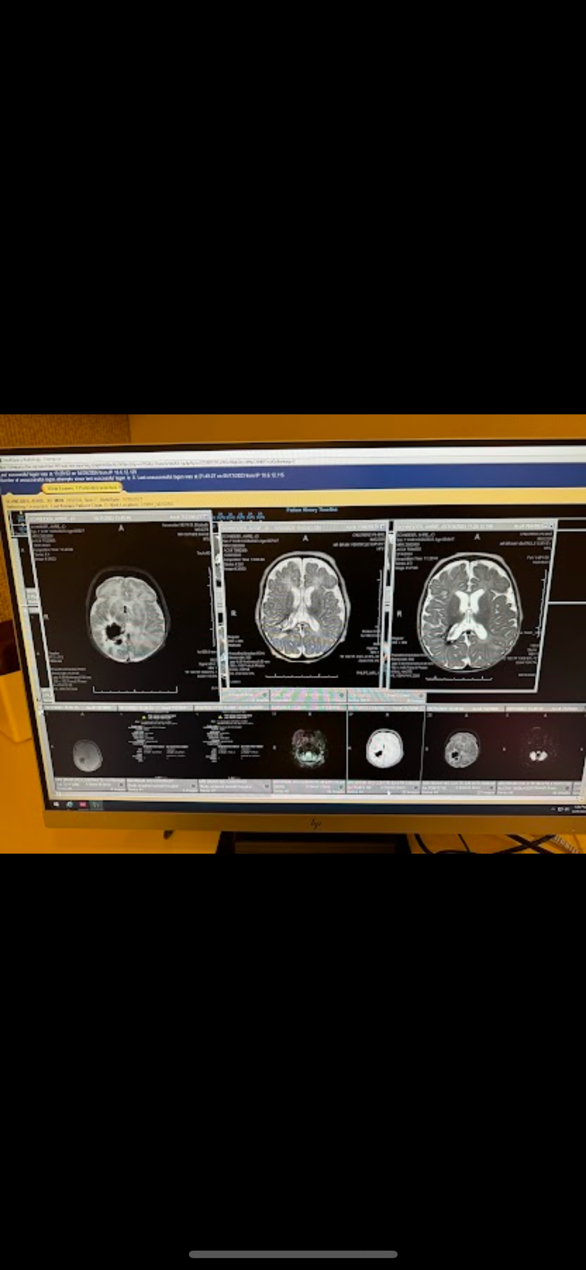 Support Ahrie Jo's Critical Brain Surgery campaign photo, 2 of 8