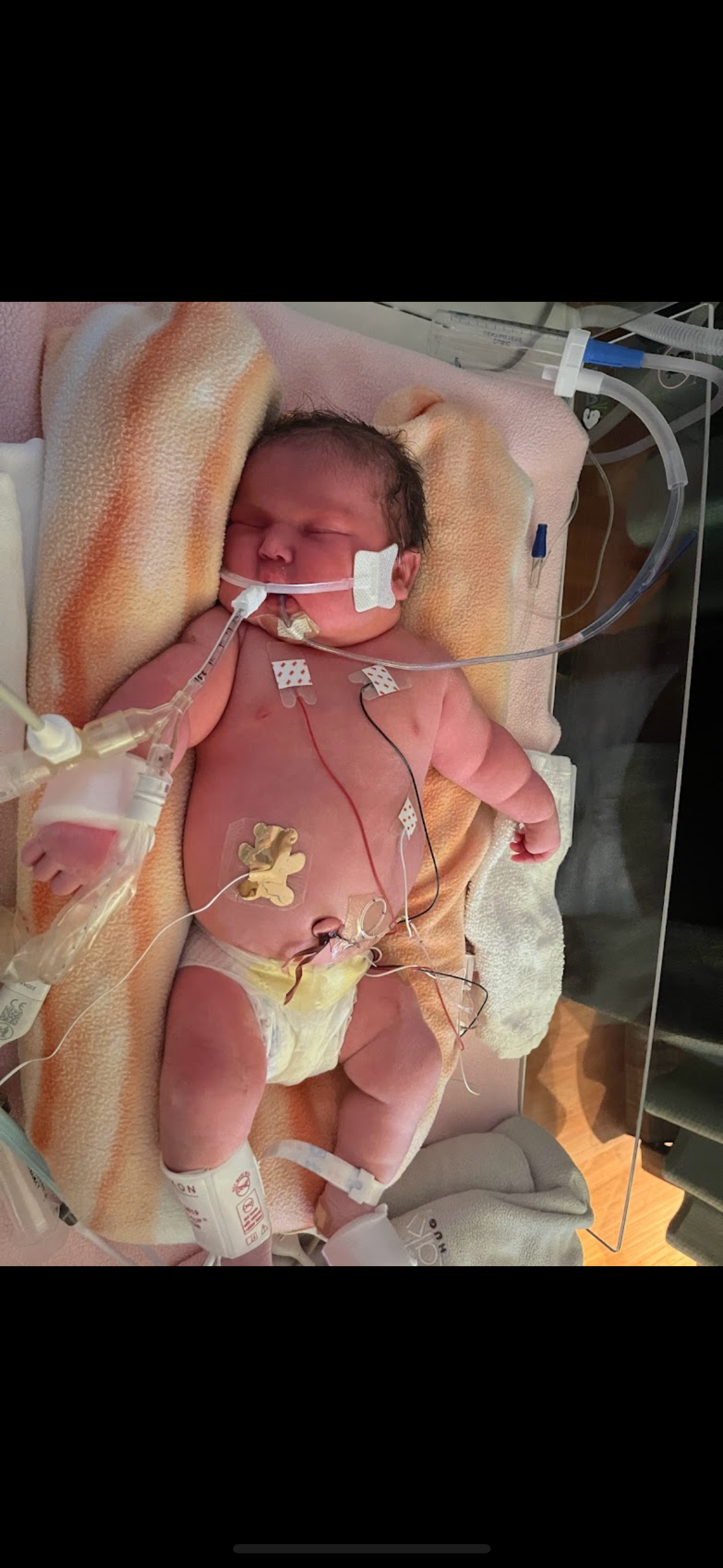 Support Ahrie Jo's Critical Brain Surgery campaign photo, 4 of 8