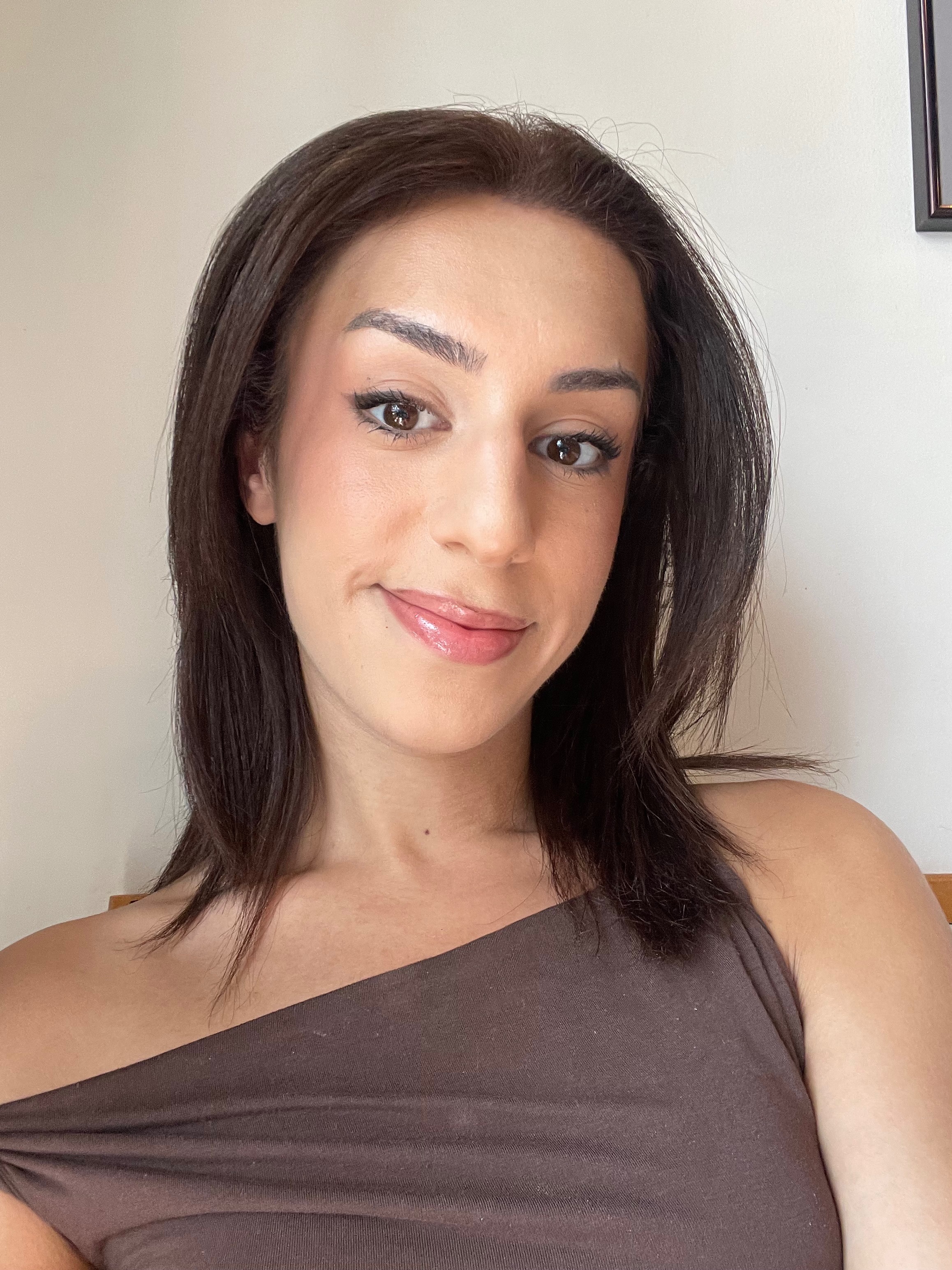Help Alia pay her FFS (Emergency) campaign photo, 4 of 5