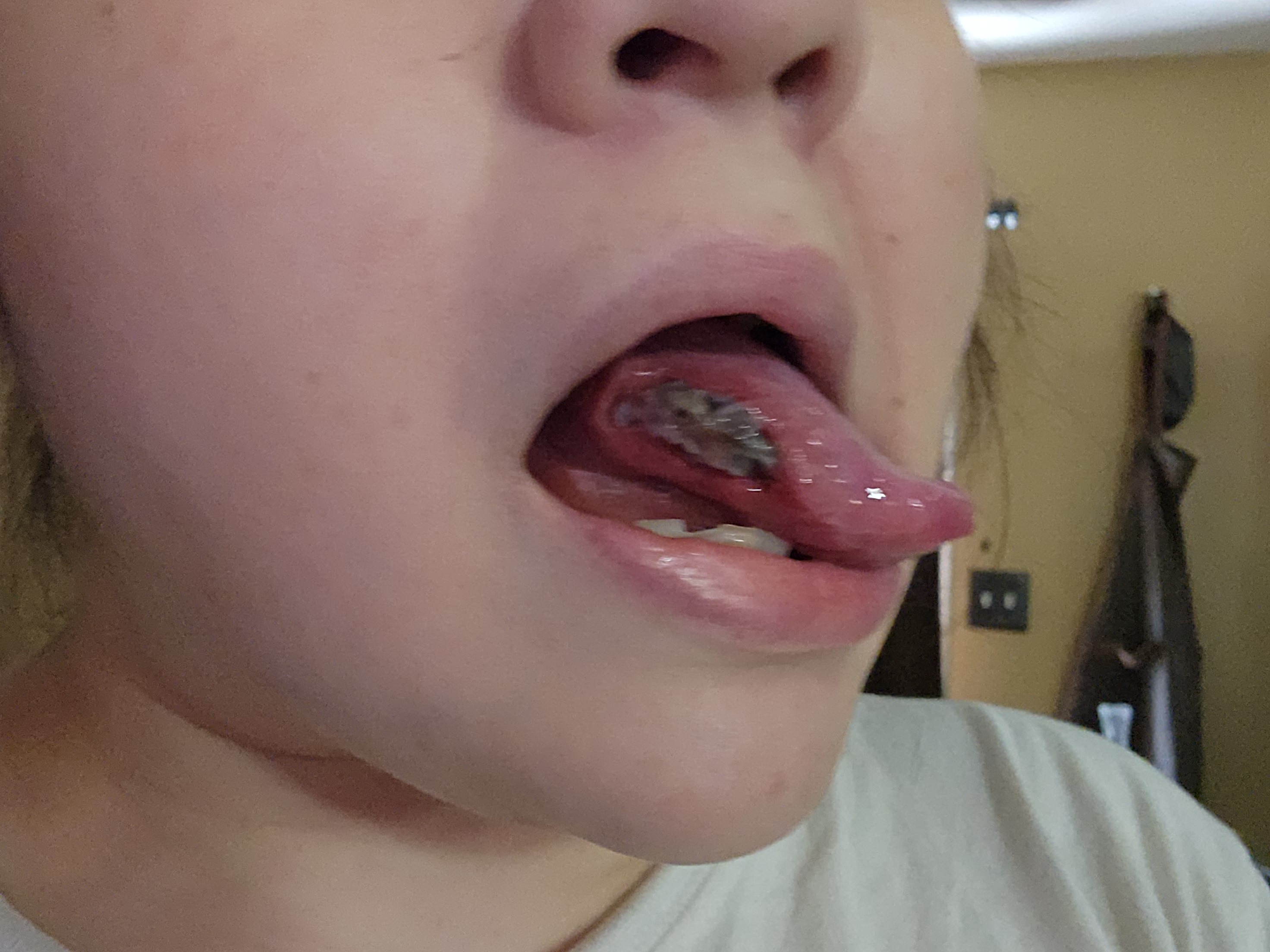 Help Christina Get Vital Epilepsy Treatment campaign photo, 7 of 8