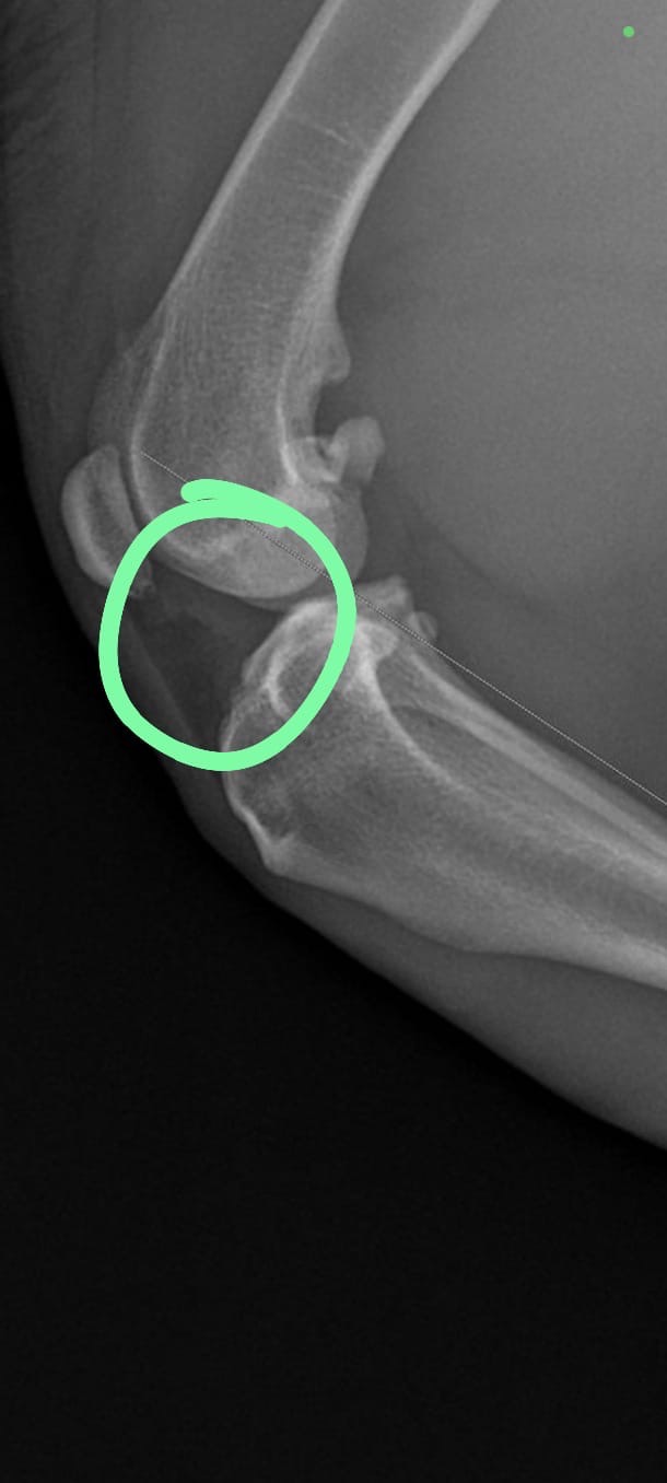 Help Grace Walk Again: Urgent Surgery Needed campaign photo, 7 of 8