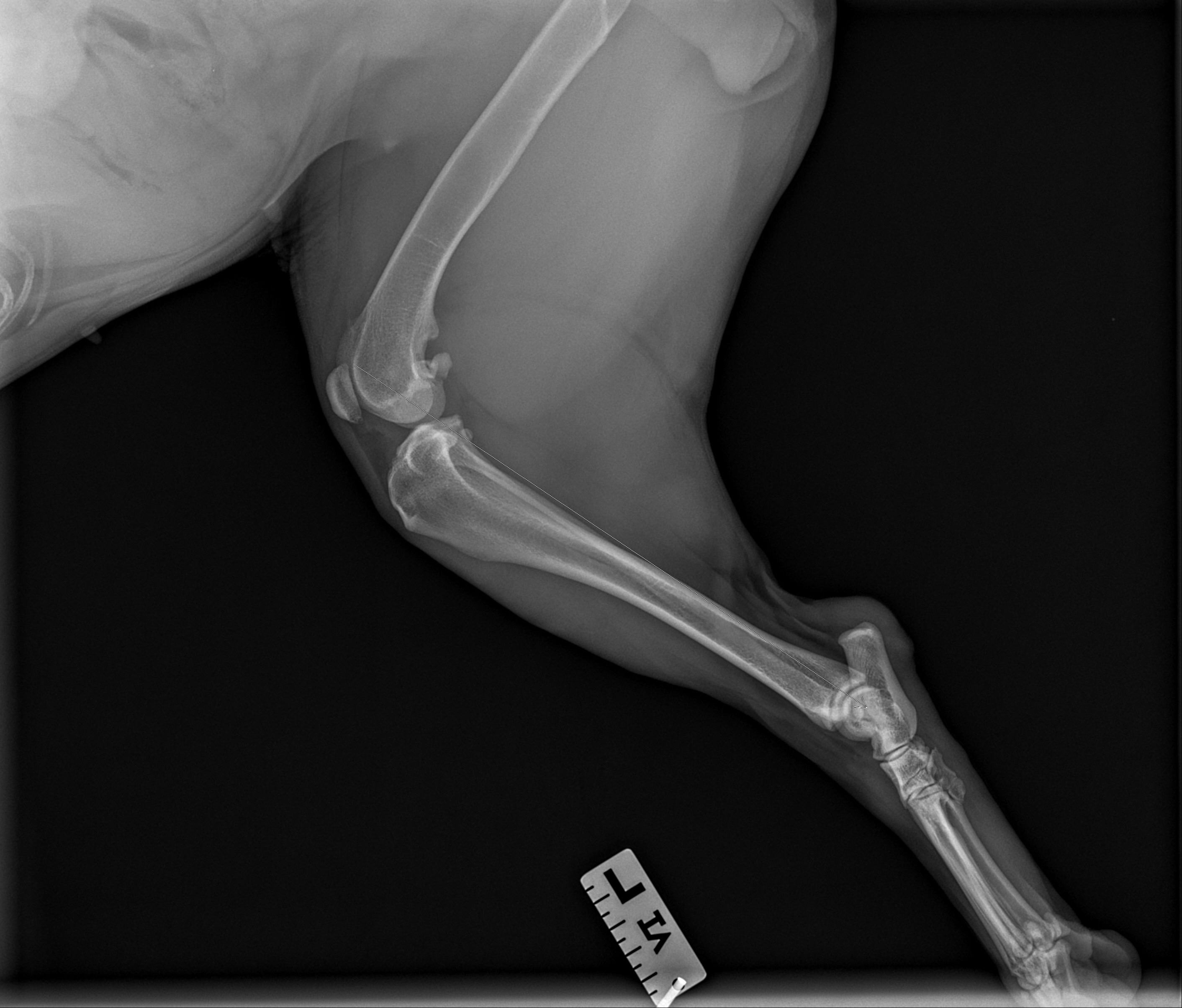 Help Grace Walk Again: Urgent Surgery Needed campaign photo, 2 of 8