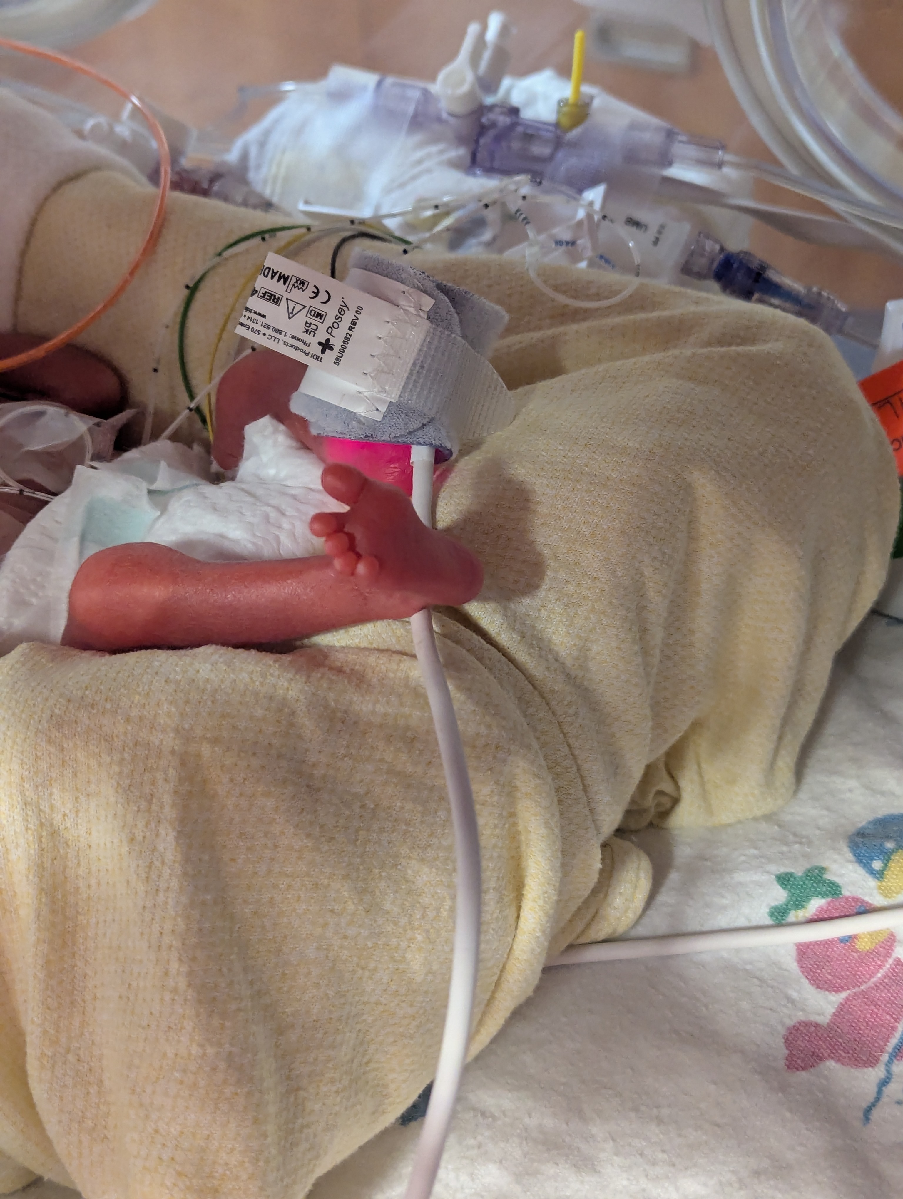 Support Beckett's NICU Journey campaign photo, 4 of 8