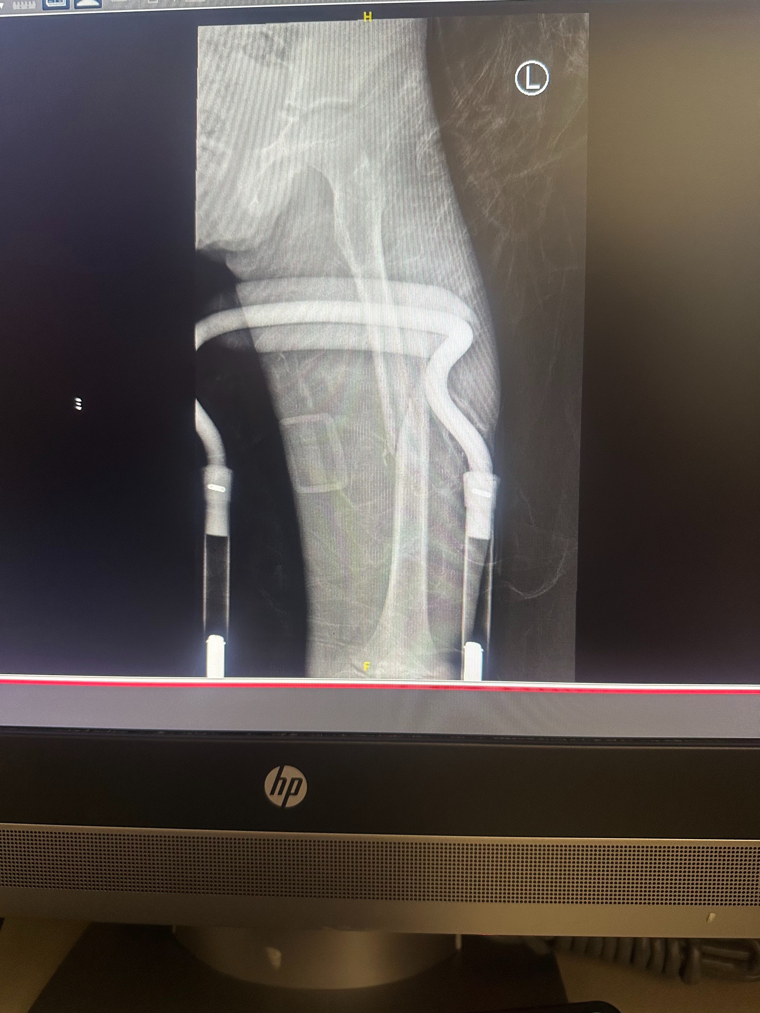 Support Cameron’s Recovery After Severe Injury campaign photo, 2 of 5