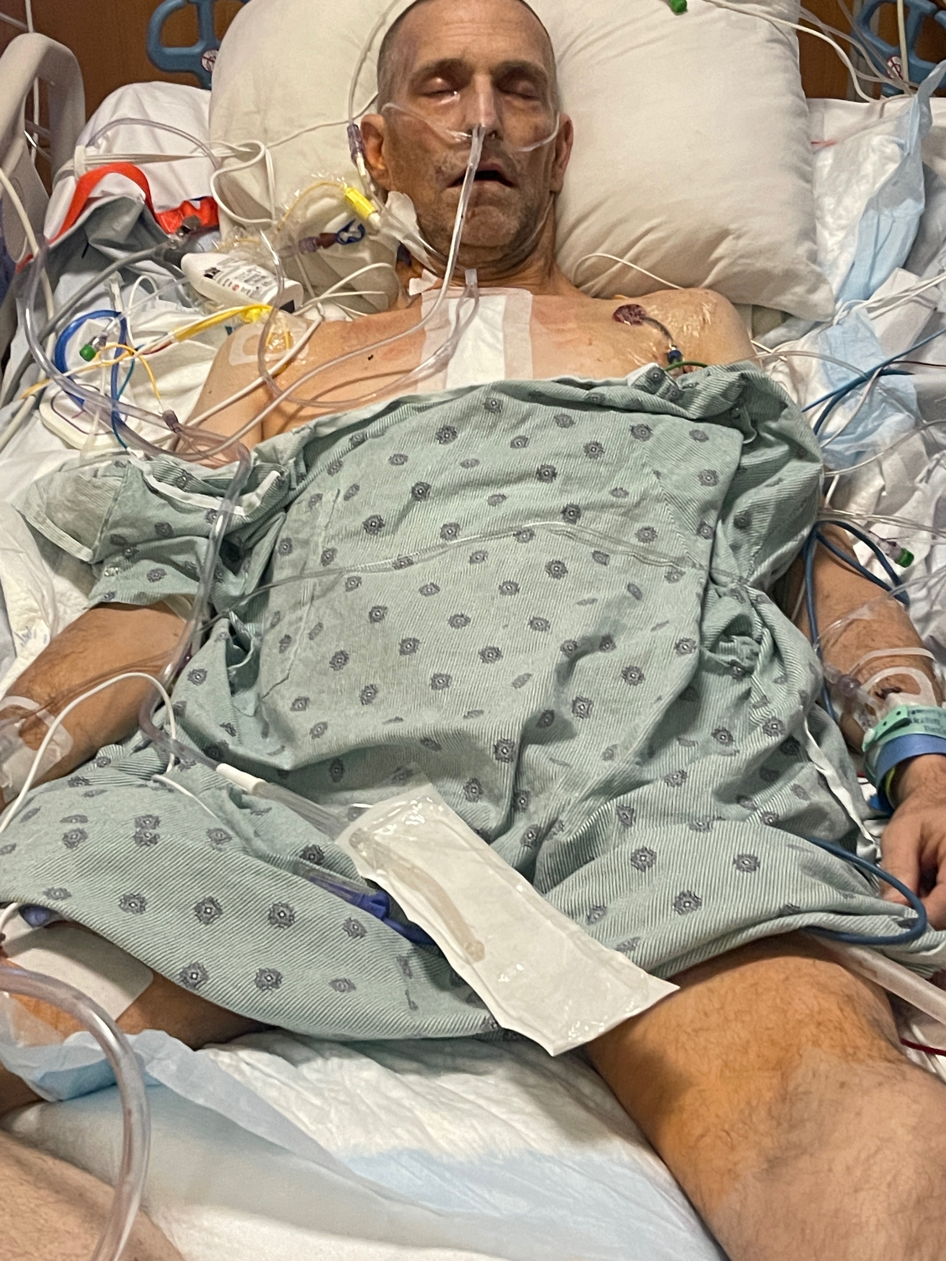 Jeffs Journey ( Jeff’s New ♥️ After Transplant ) campaign photo, 5 of 8
