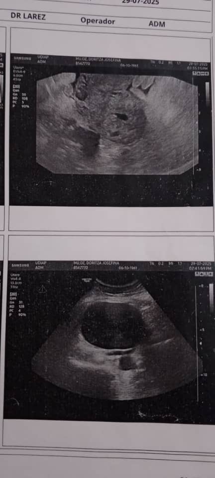 Doritza Muñoz diagnosticada con tumor de ovario campaign photo, 5 of 6