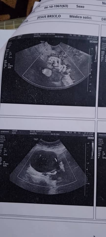 Doritza Muñoz diagnosticada con tumor de ovario campaign photo, 2 of 6