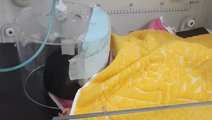 “Baby With Dwarfism & Heart Condition Needs Urgent Care” photo