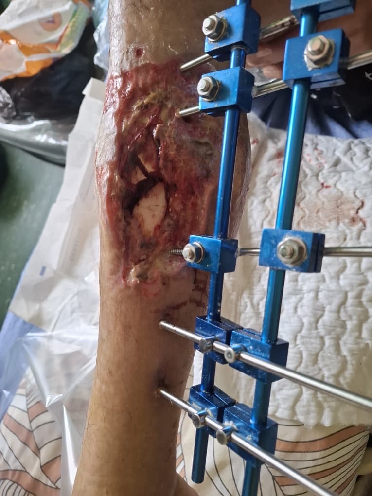 Apoyo urgente por la recuperacion de mi papa campaign photo, 2 of 8
