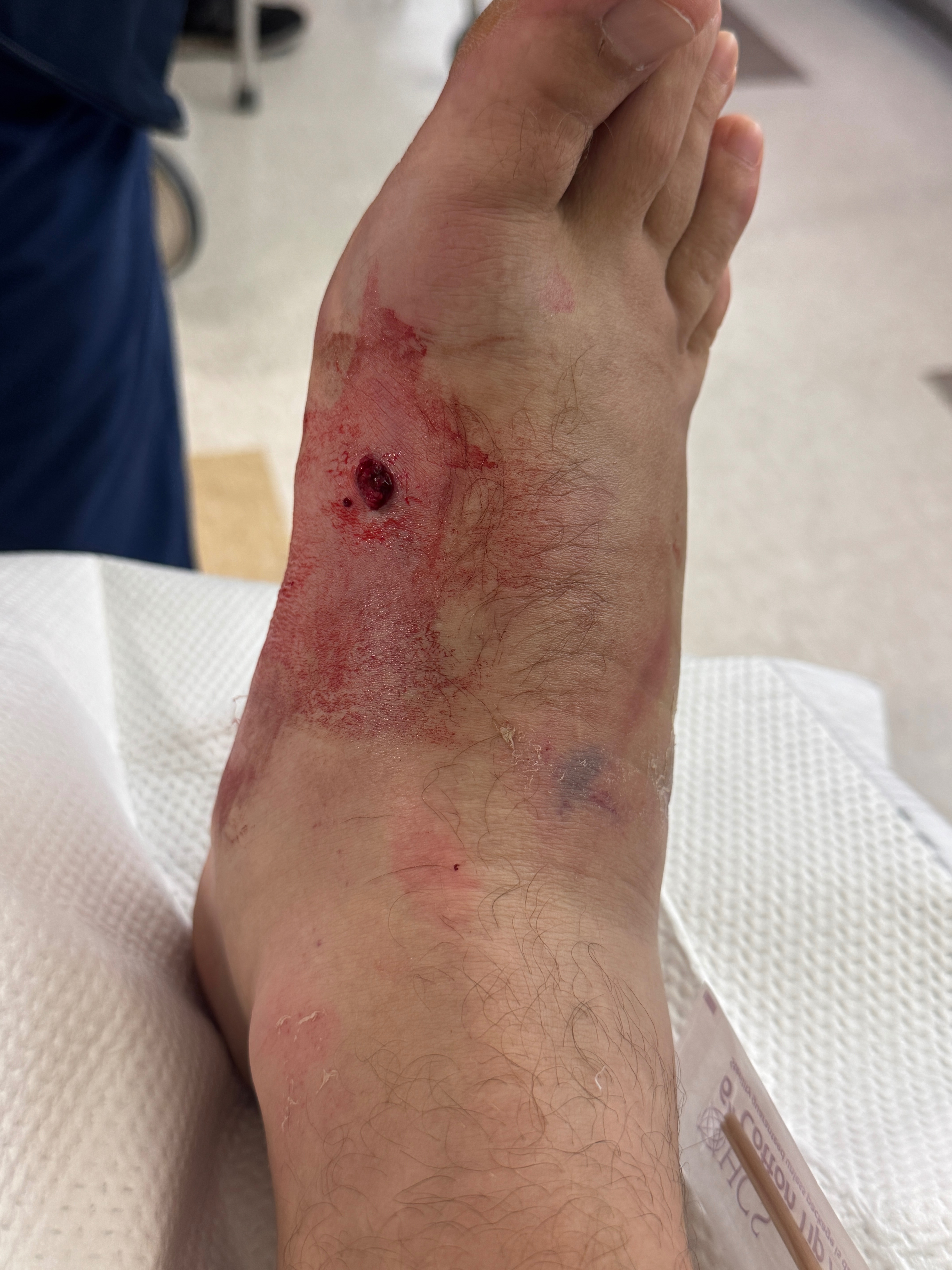 Help Support Thomas  After His Motorcycle Accident campaign photo, 2 of 8