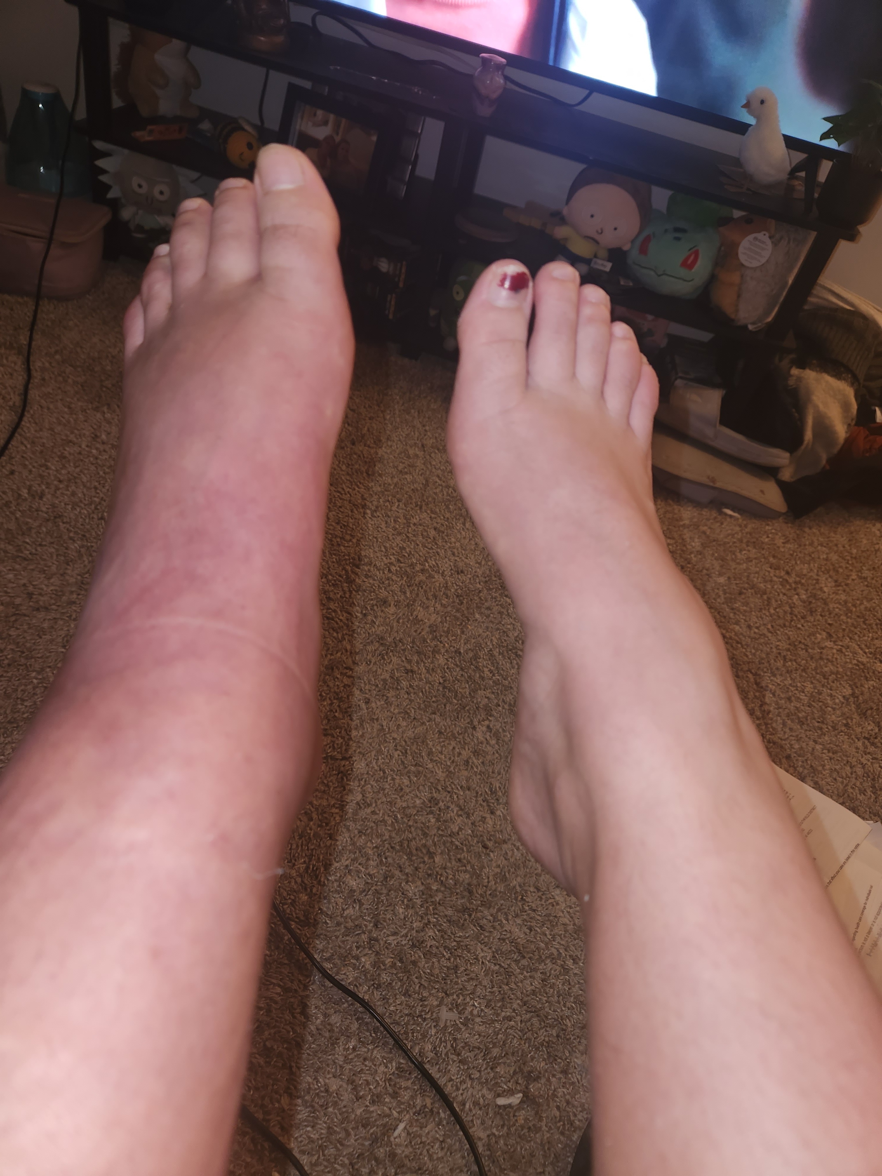 Help support Katie for ankle surgery and recovery campaign photo, 4 of 6