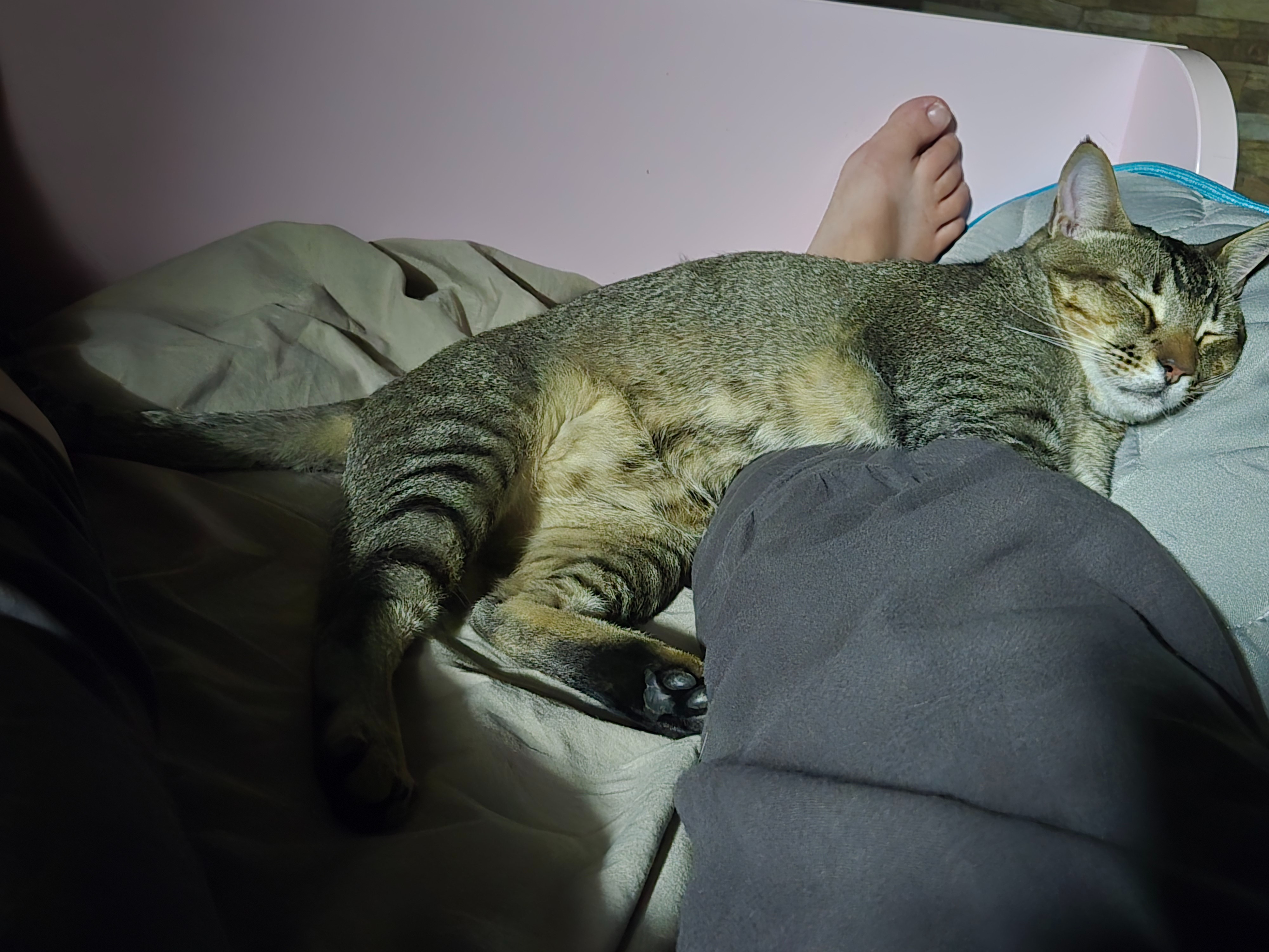 Scar's Leg Surgery campaign photo, 7 of 8