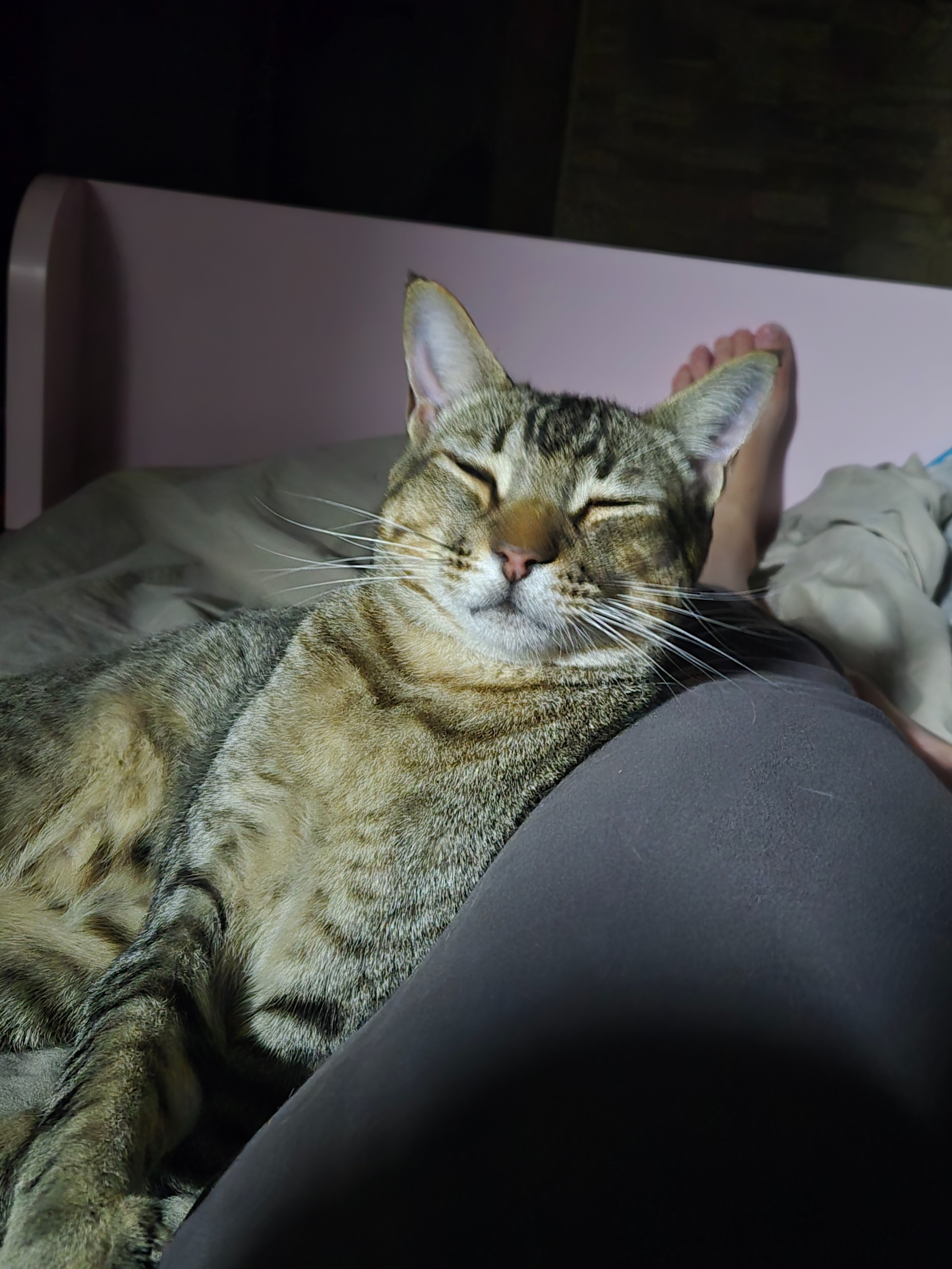 Scar's Leg Surgery campaign photo, 2 of 8