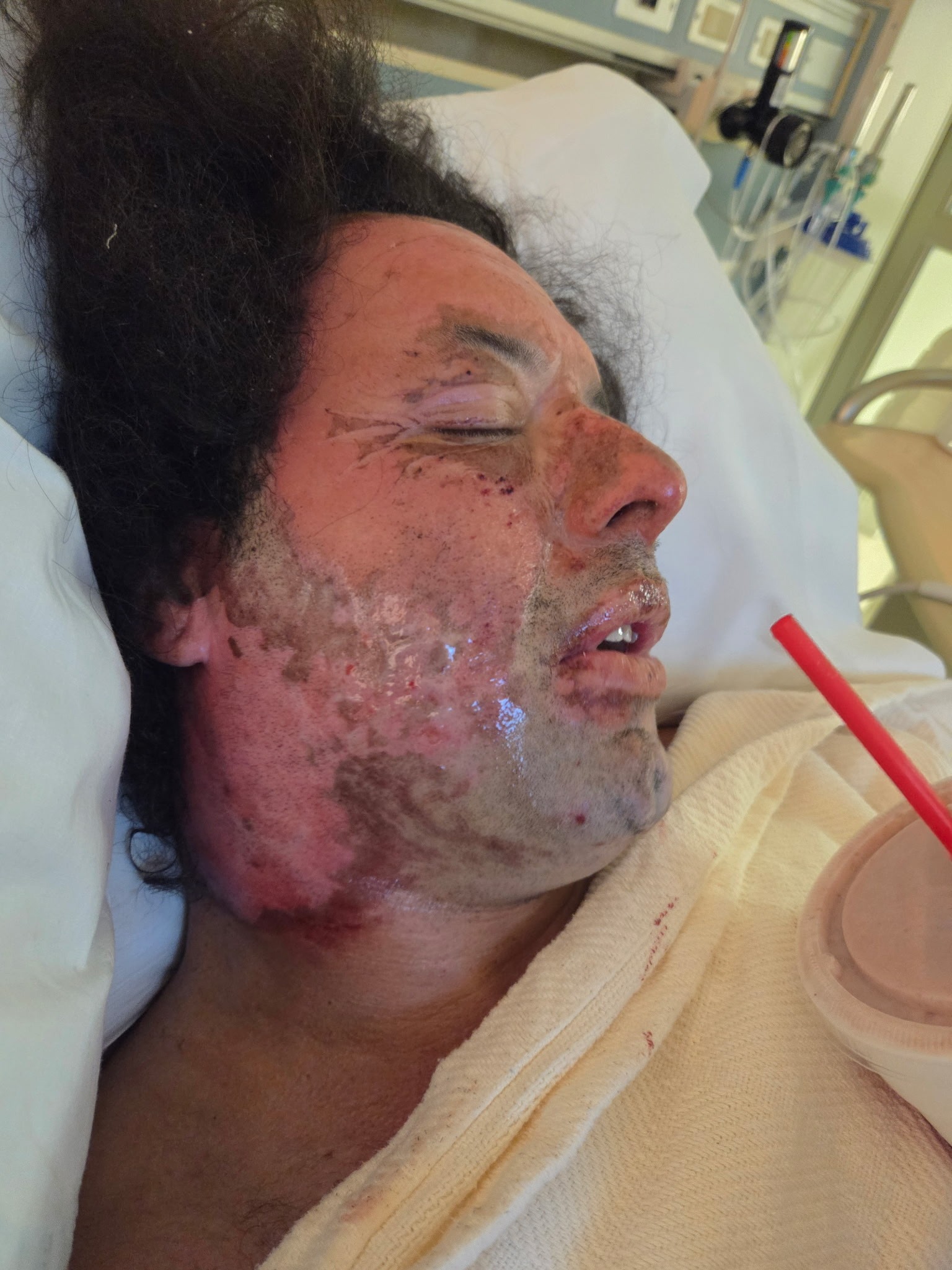 Help Support Jr After a Tragic Accident campaign photo, 4 of 6