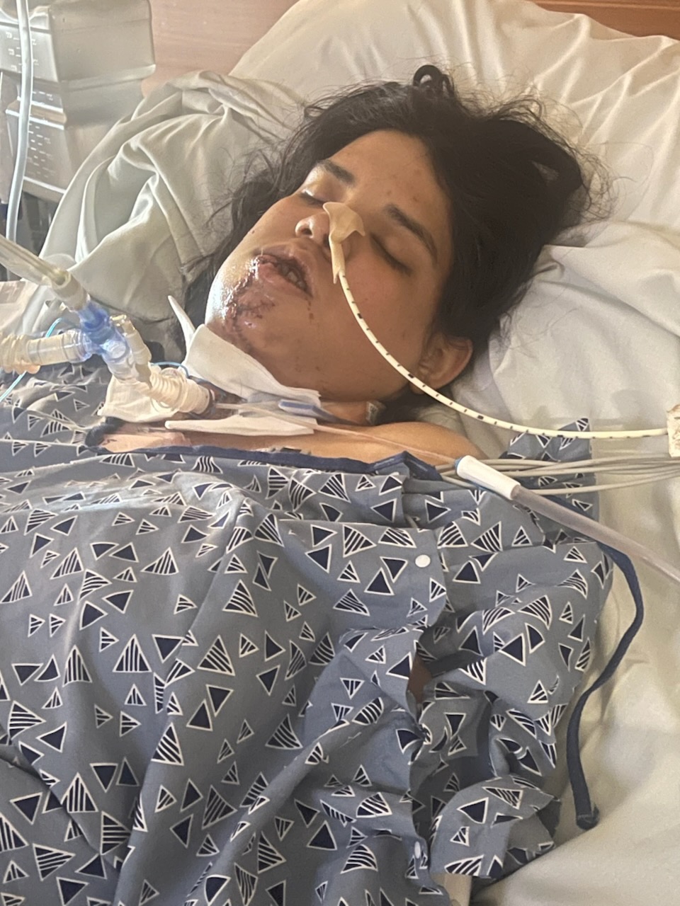 Help Aliciana Heal after Surviving 11 Gunshot Wounds campaign photo, 2 of 8