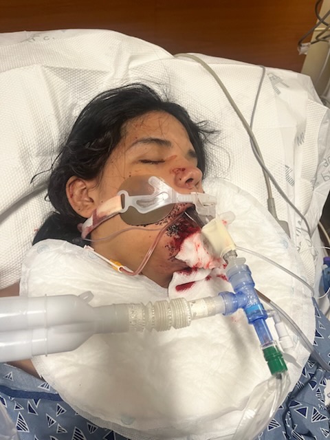 Help Aliciana Heal after Surviving 11 Gunshot Wounds campaign photo, 5 of 8
