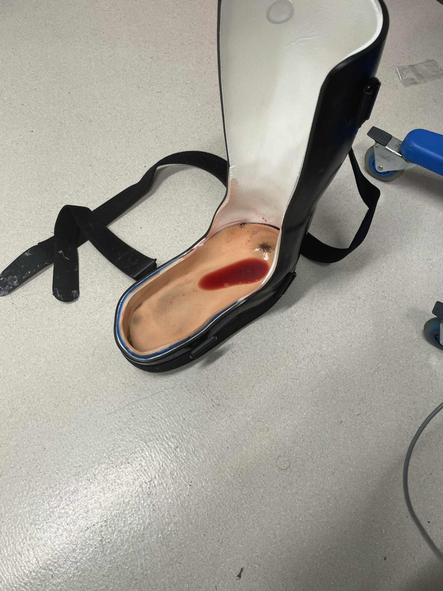 Amputation surgery campaign photo, 4 of 6