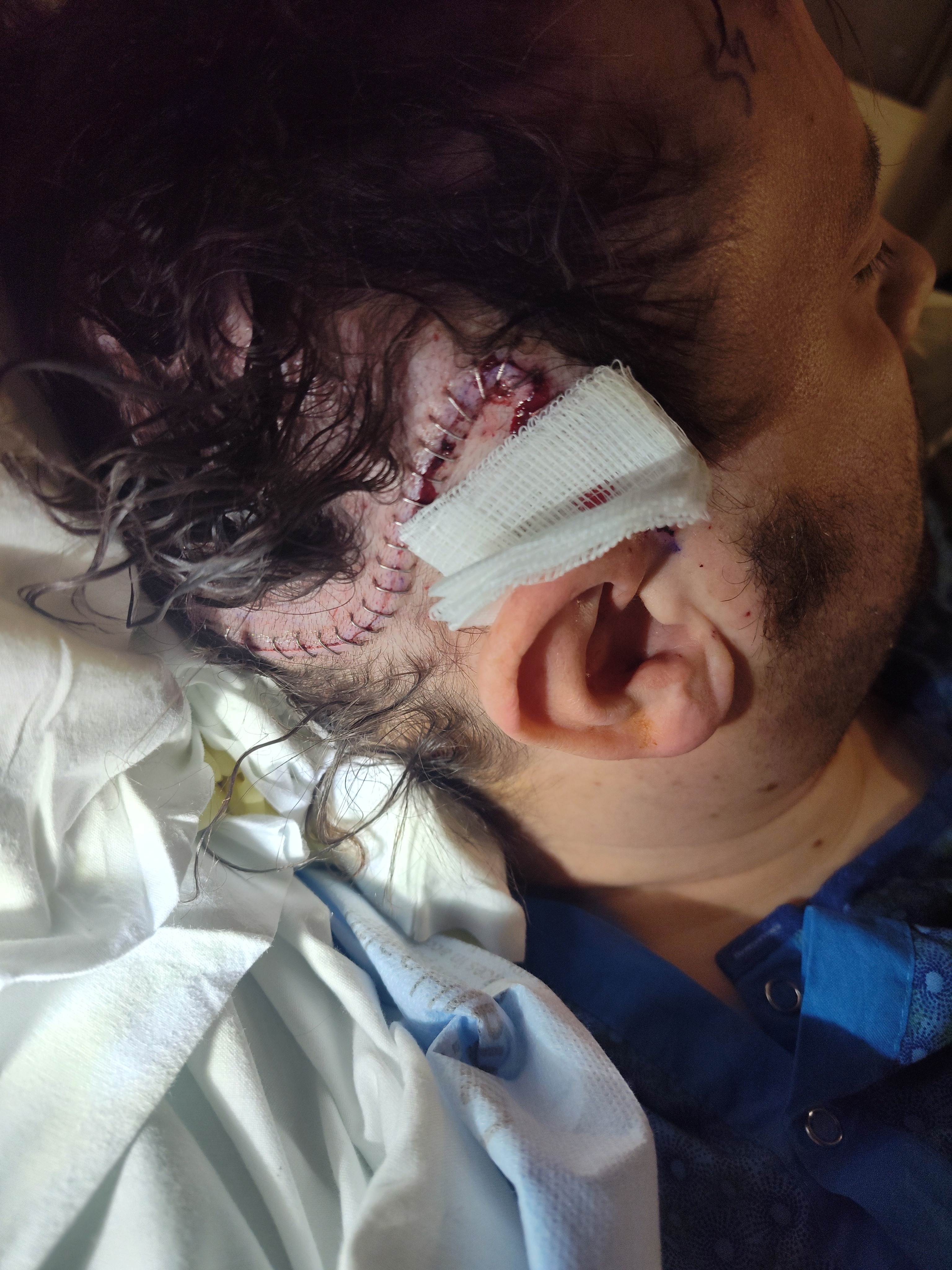 Dan Benoit fighting astrocytoma campaign photo, 2 of 5