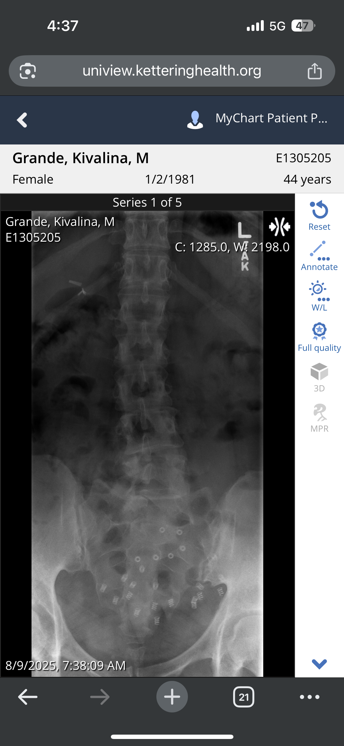 Support for Kivy’s back surgery recovery campaign photo, 6 of 8