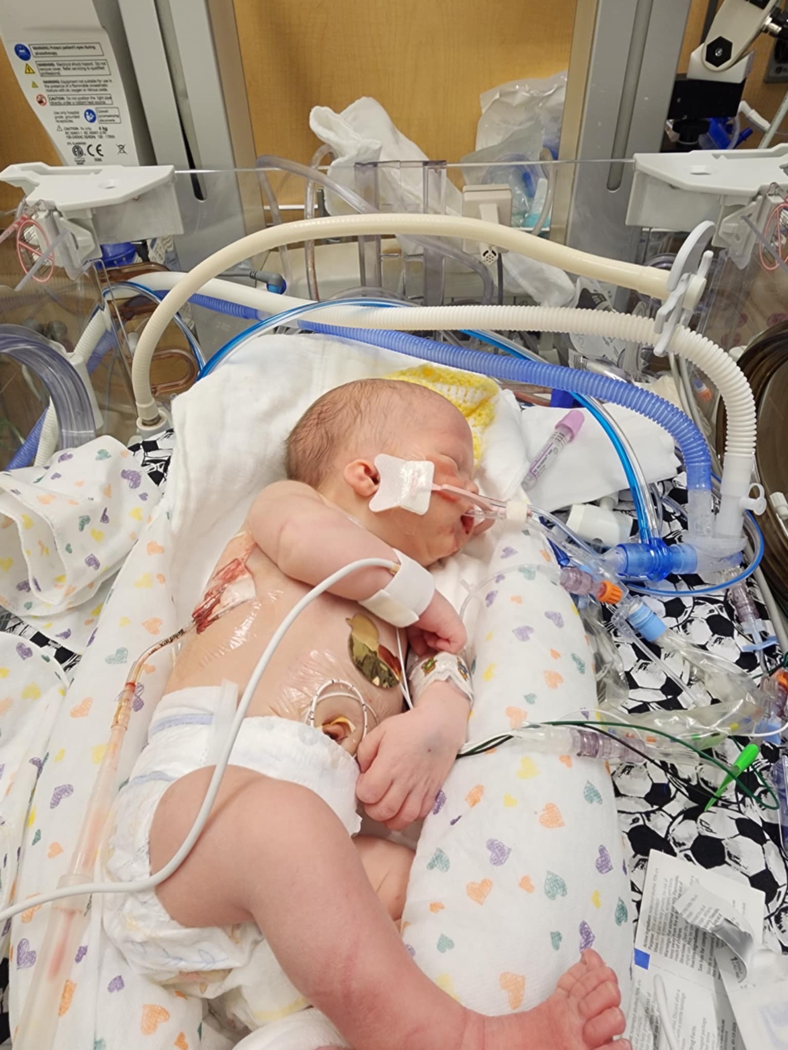 Baby Ro’s Nicu Journey campaign photo, 4 of 8