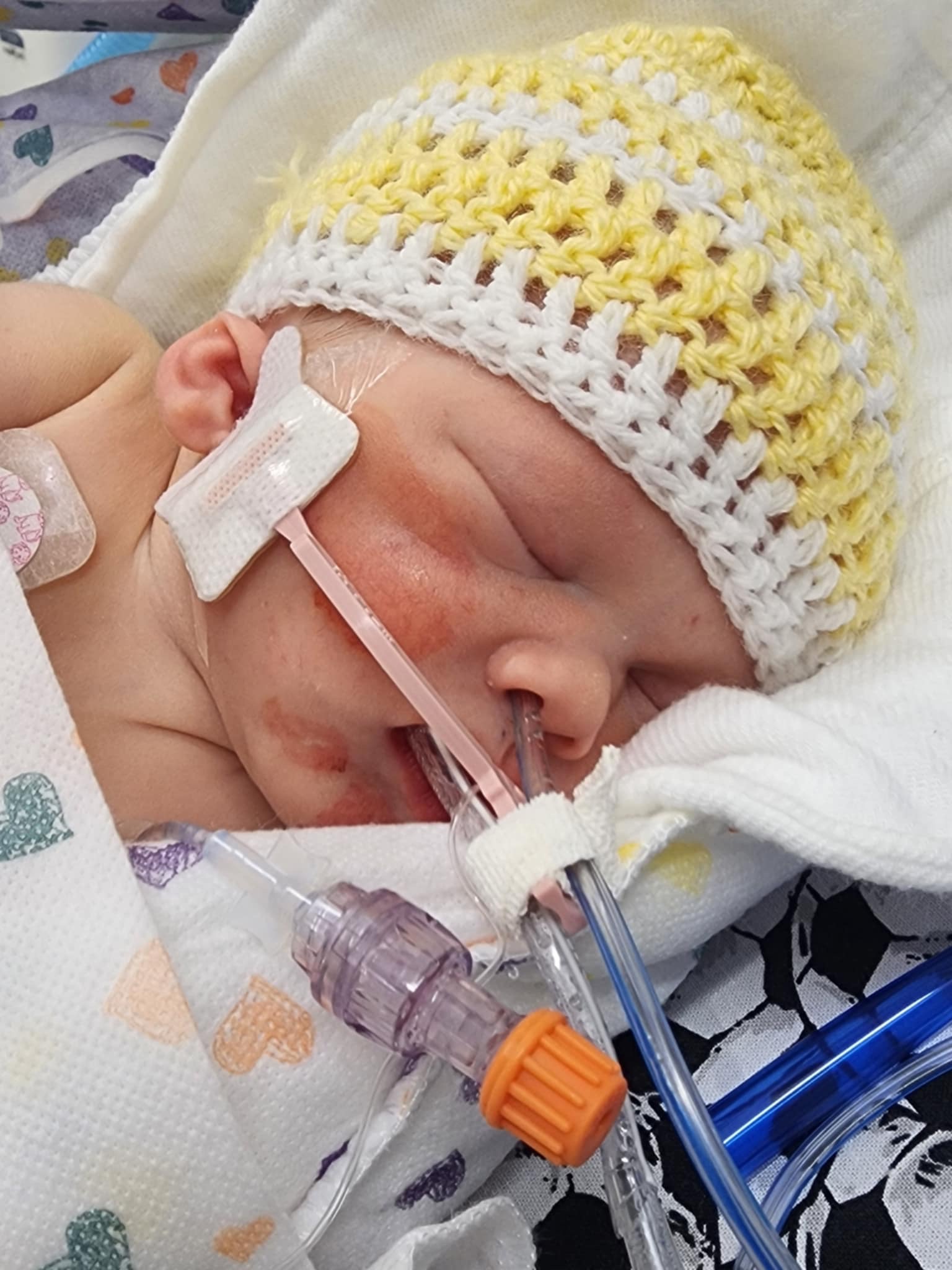 Baby Ro’s Nicu Journey campaign photo, 2 of 8