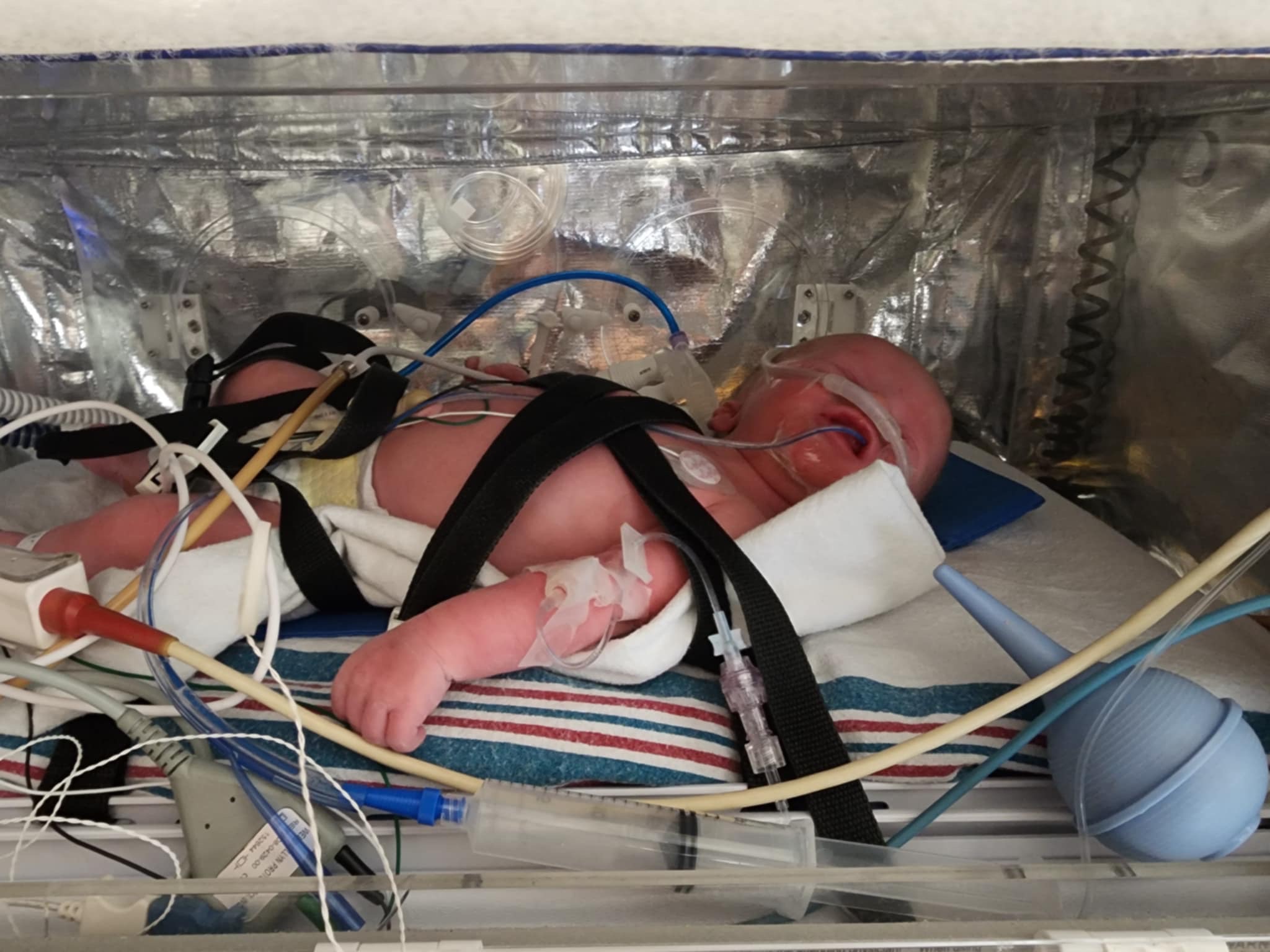 Baby Ro’s Nicu Journey campaign photo, 5 of 8