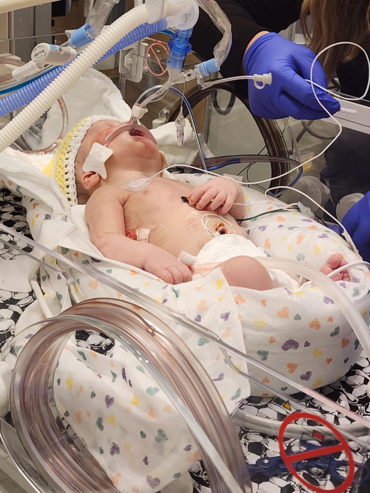 Baby Ro’s Nicu Journey campaign photo, 6 of 8
