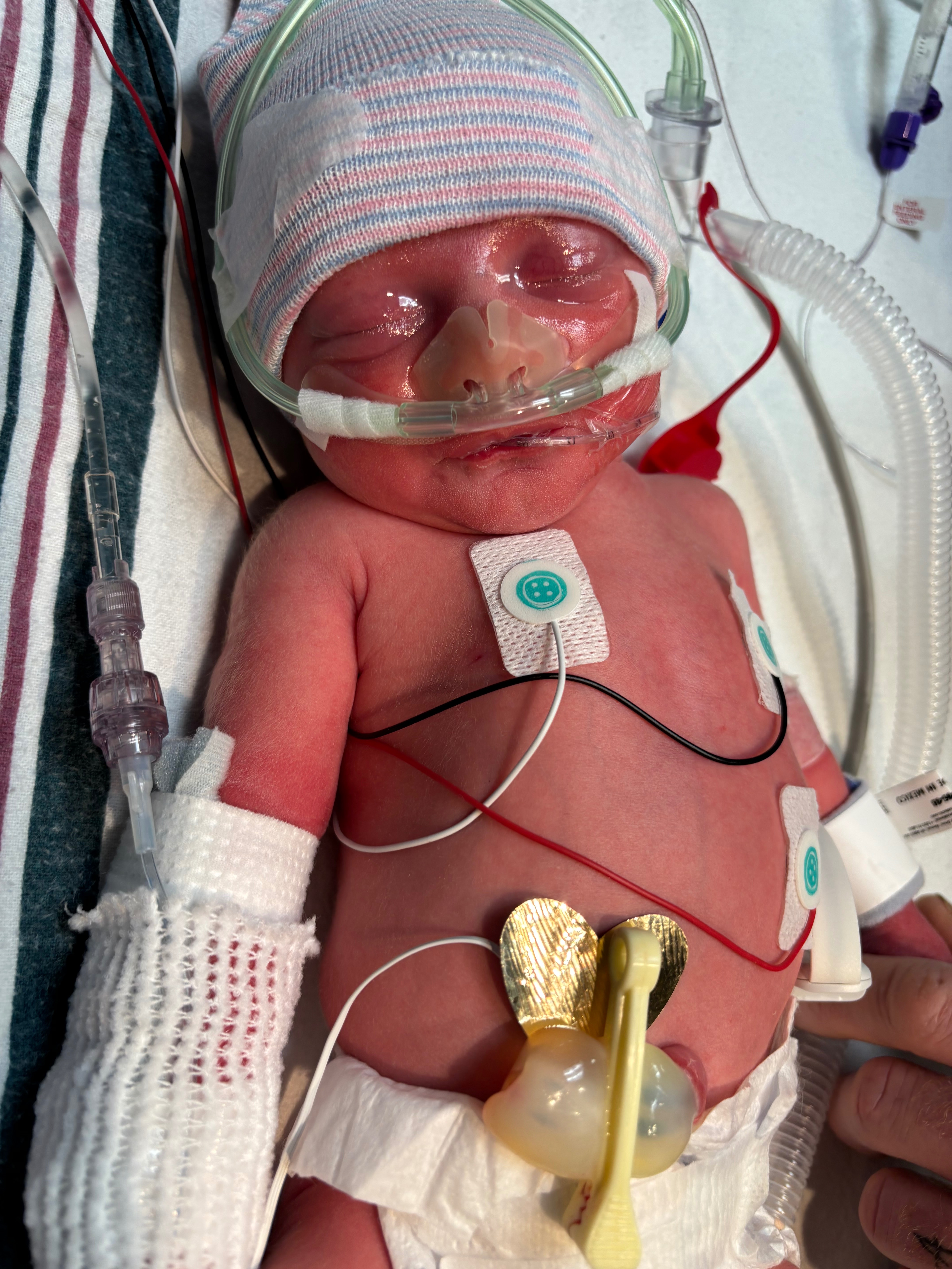 Aid for Octavia's Medical Travel campaign photo, 4 of 6