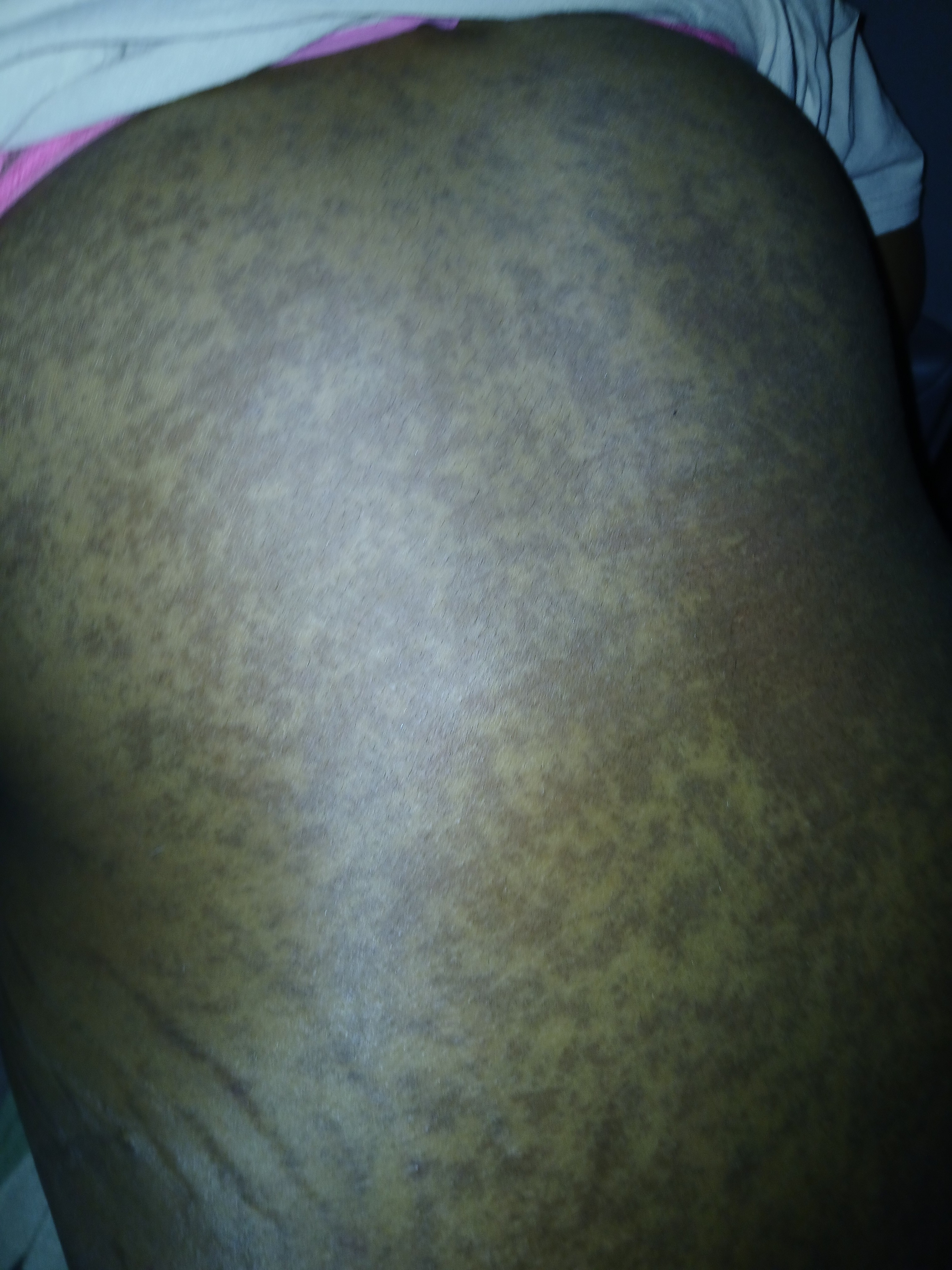 PLEASE HELPCERVICAL CANCER PATIENT WIT 4 BOYS MAKE IT campaign photo, 6 of 8