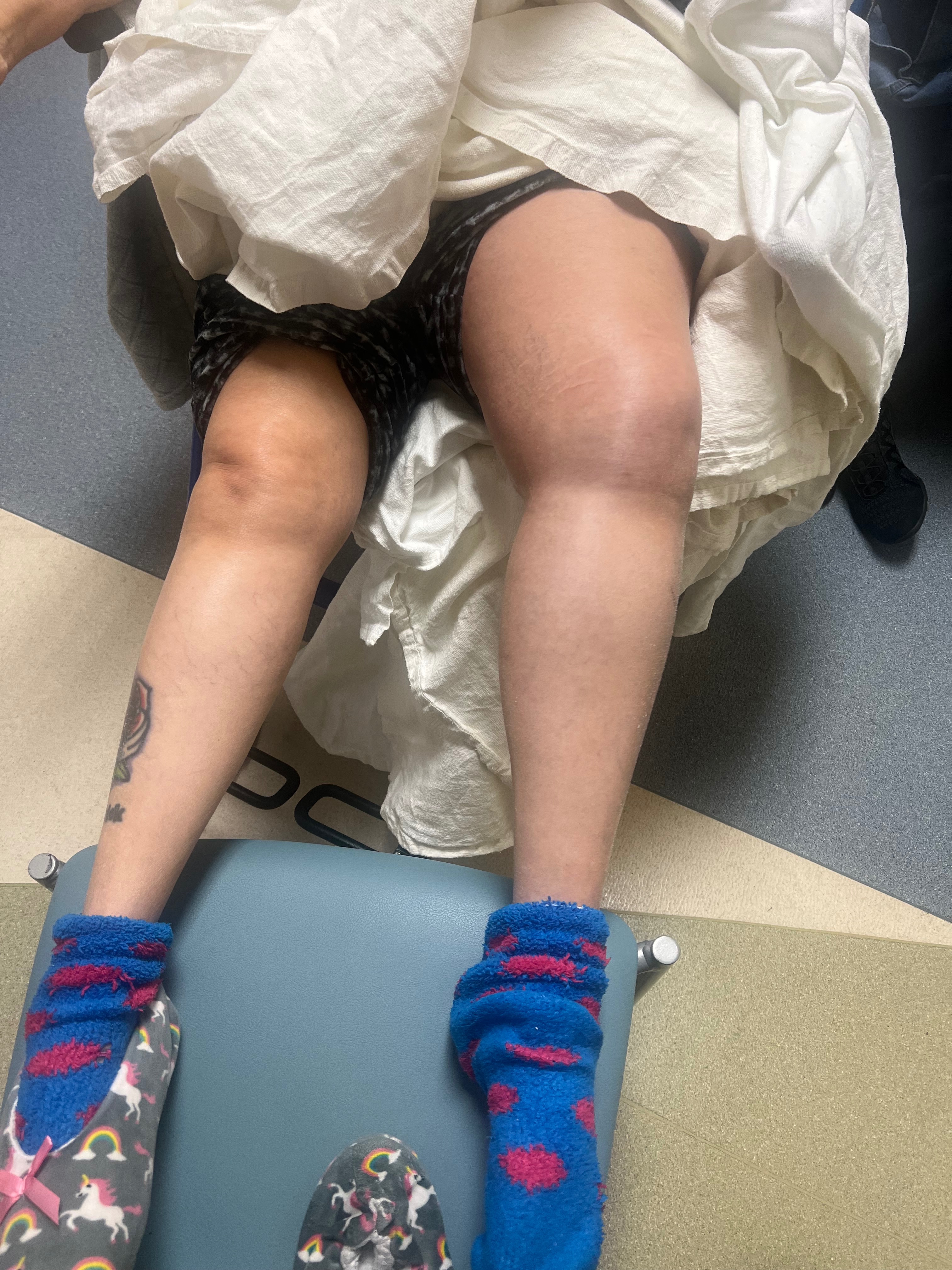 Support Patricia's Journey to Recovery campaign photo, 2 of 5