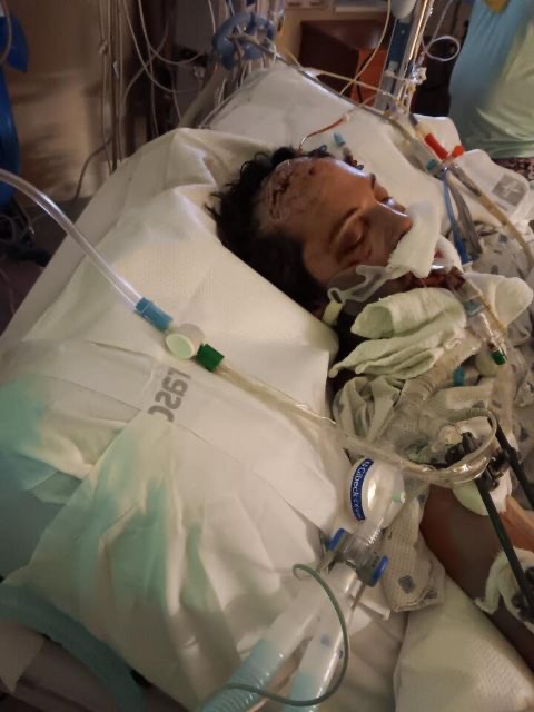 Support Ian Clark's Critical Recovery Journey campaign photo, 2 of 7