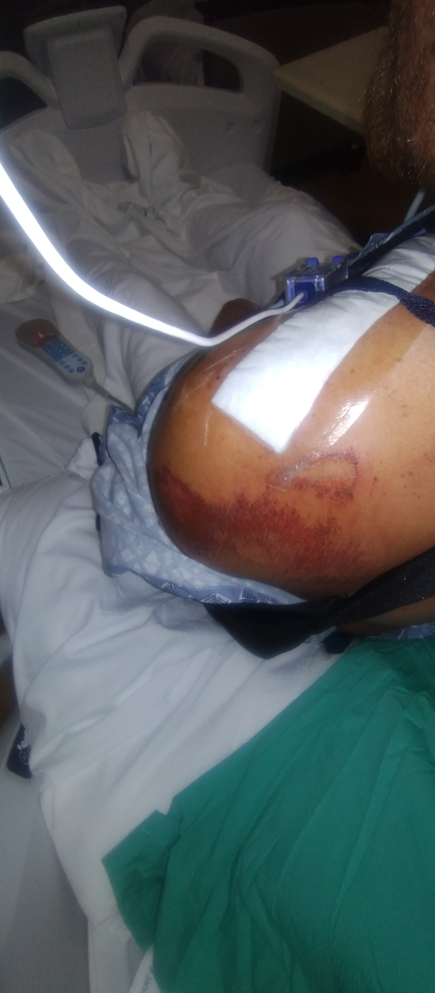 Ebike accident changed my life campaign photo, 6 of 7