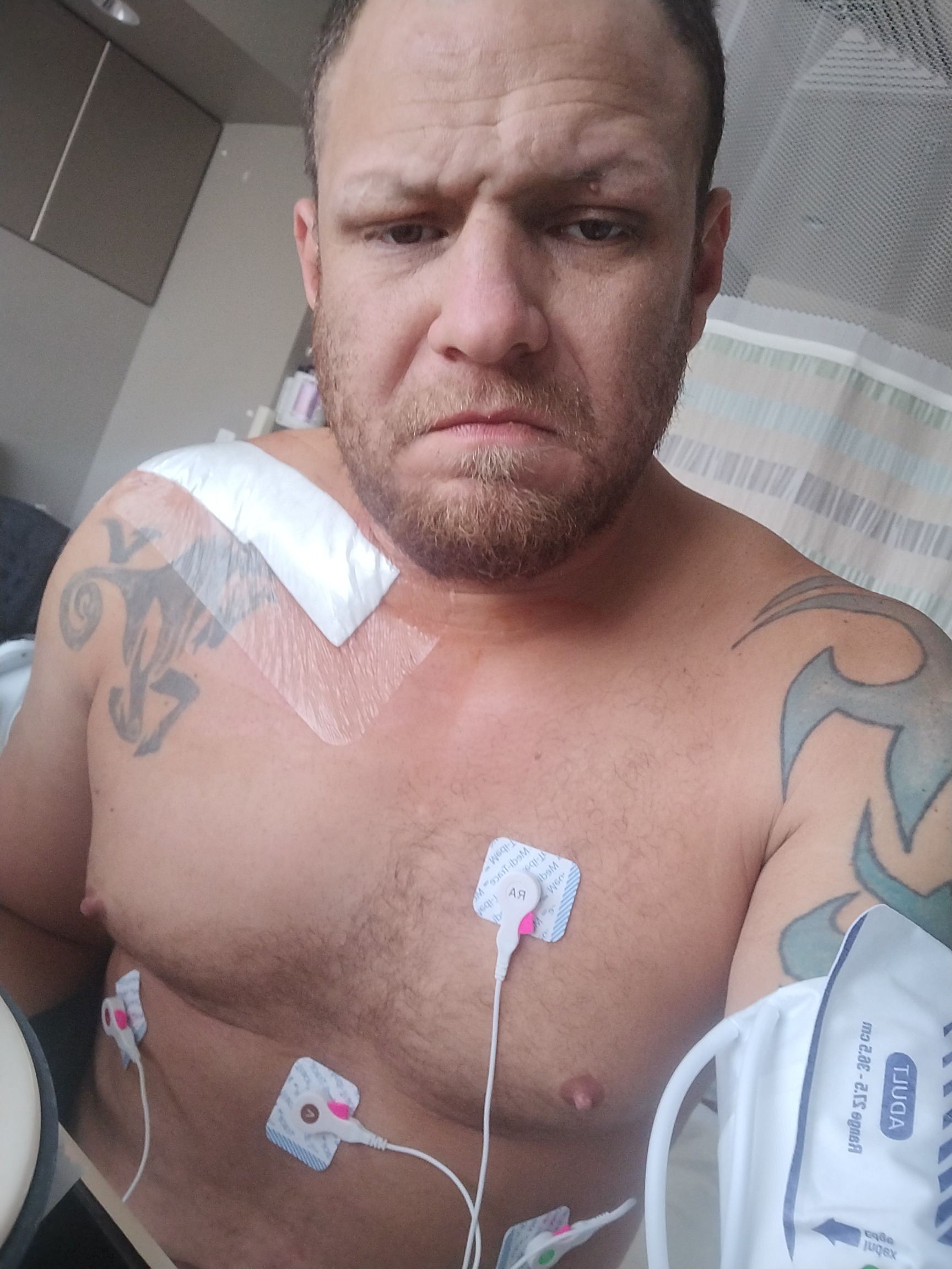 Ebike accident changed my life campaign photo, 2 of 7