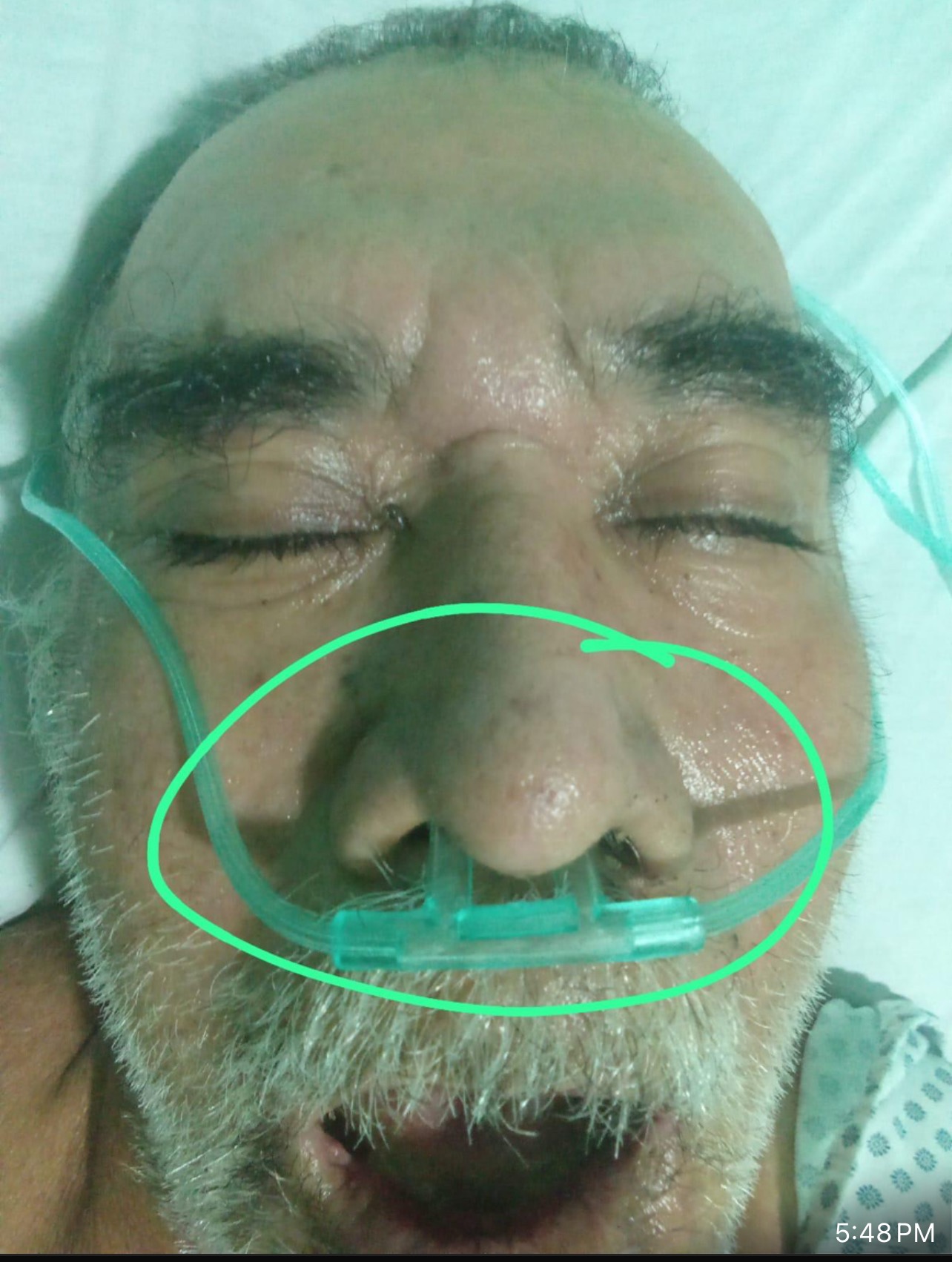 Donations for my uncle’s treatment, medications & procedures campaign photo, 4 of 5