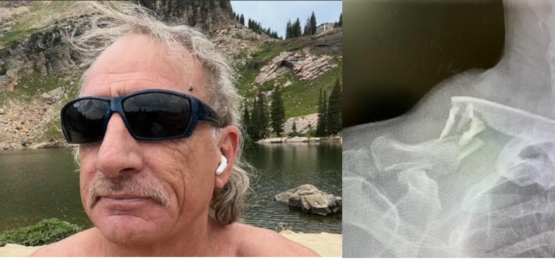 Help "Wasatch" Dave Wasek through his recovery campaign photo, 4 of 5
