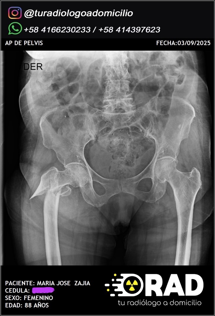 Urgent Surgery Needed for Rayma's Mom campaign photo, 2 of 4