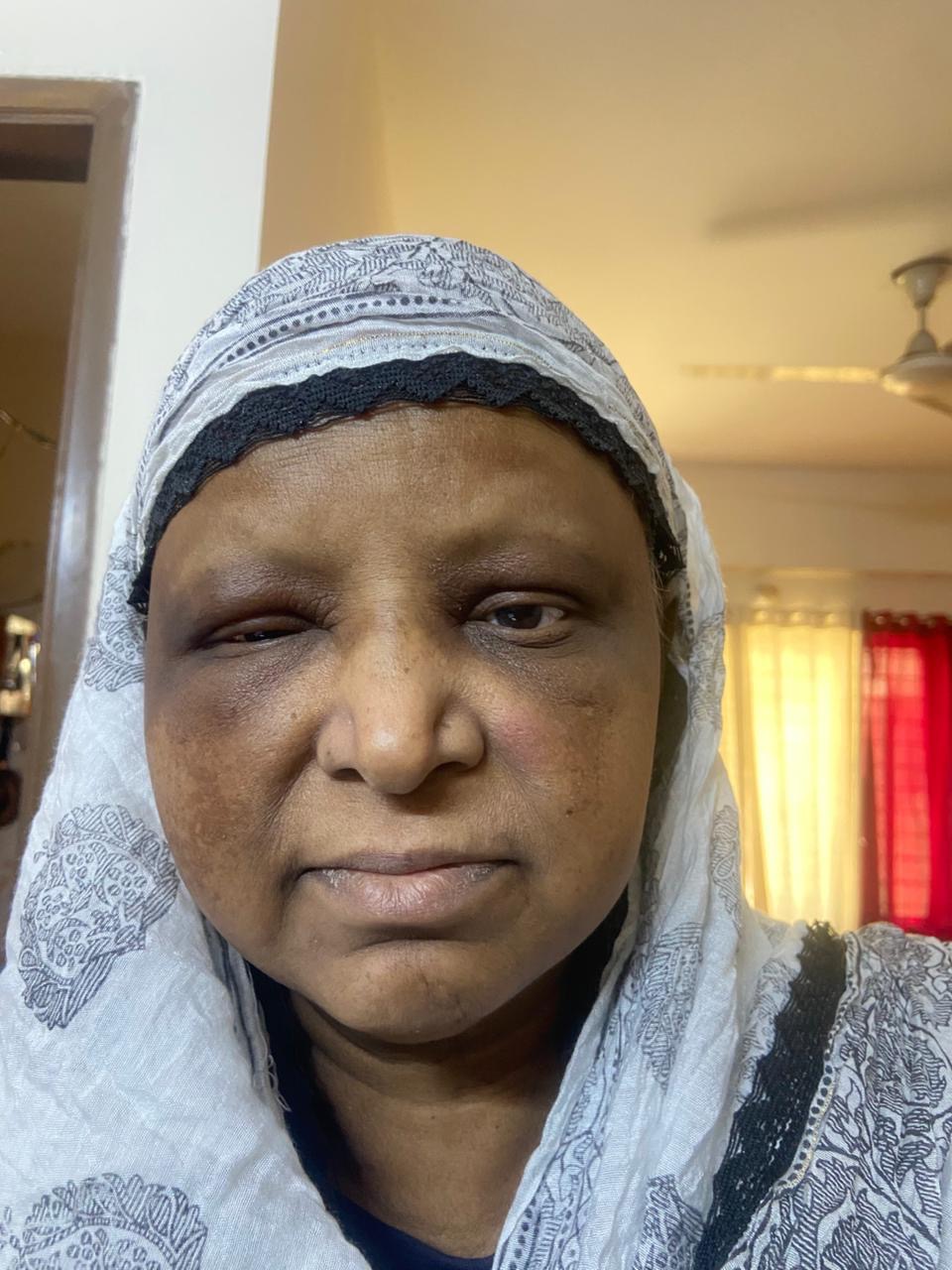 Help My Mother Fight ESR1-Mutated Breast Cancer campaign photo, 4 of 6
