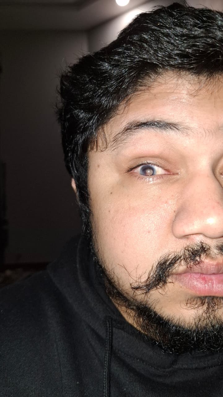 Please Help Me Save My Vision After a Medical Accident campaign photo, 7 of 8