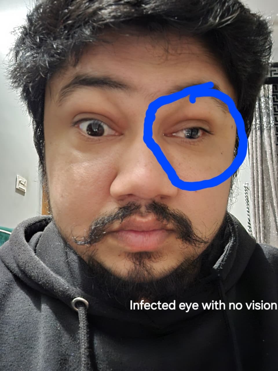 Please Help Me Save My Vision After a Medical Accident campaign photo, 2 of 8