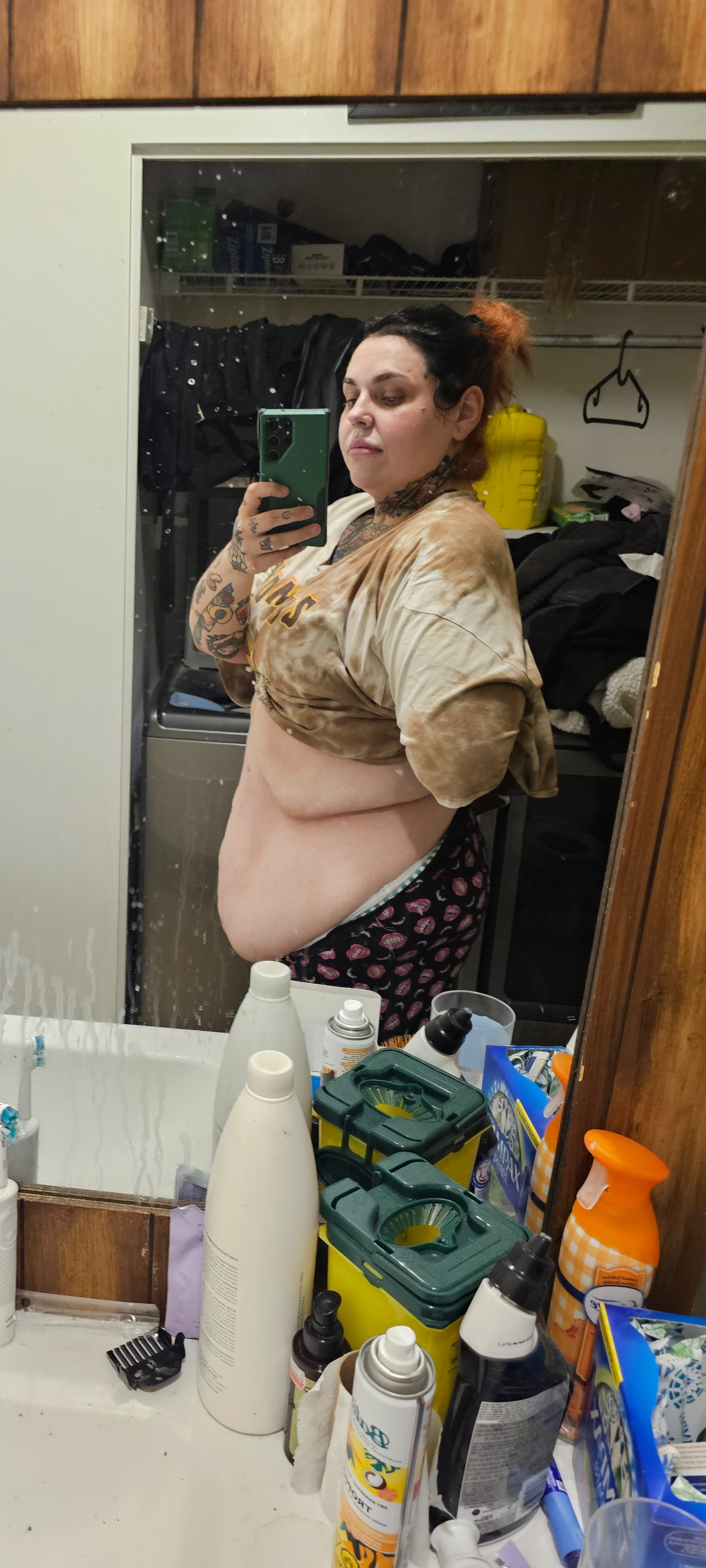 The last step of my weight loss journey.. Skin removal! campaign photo, 2 of 7